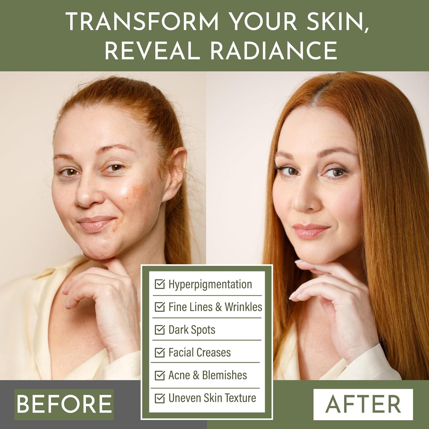 Aceite Facial Layla Mae Paracress 60 mL - Hidratante Antienvejecimiento