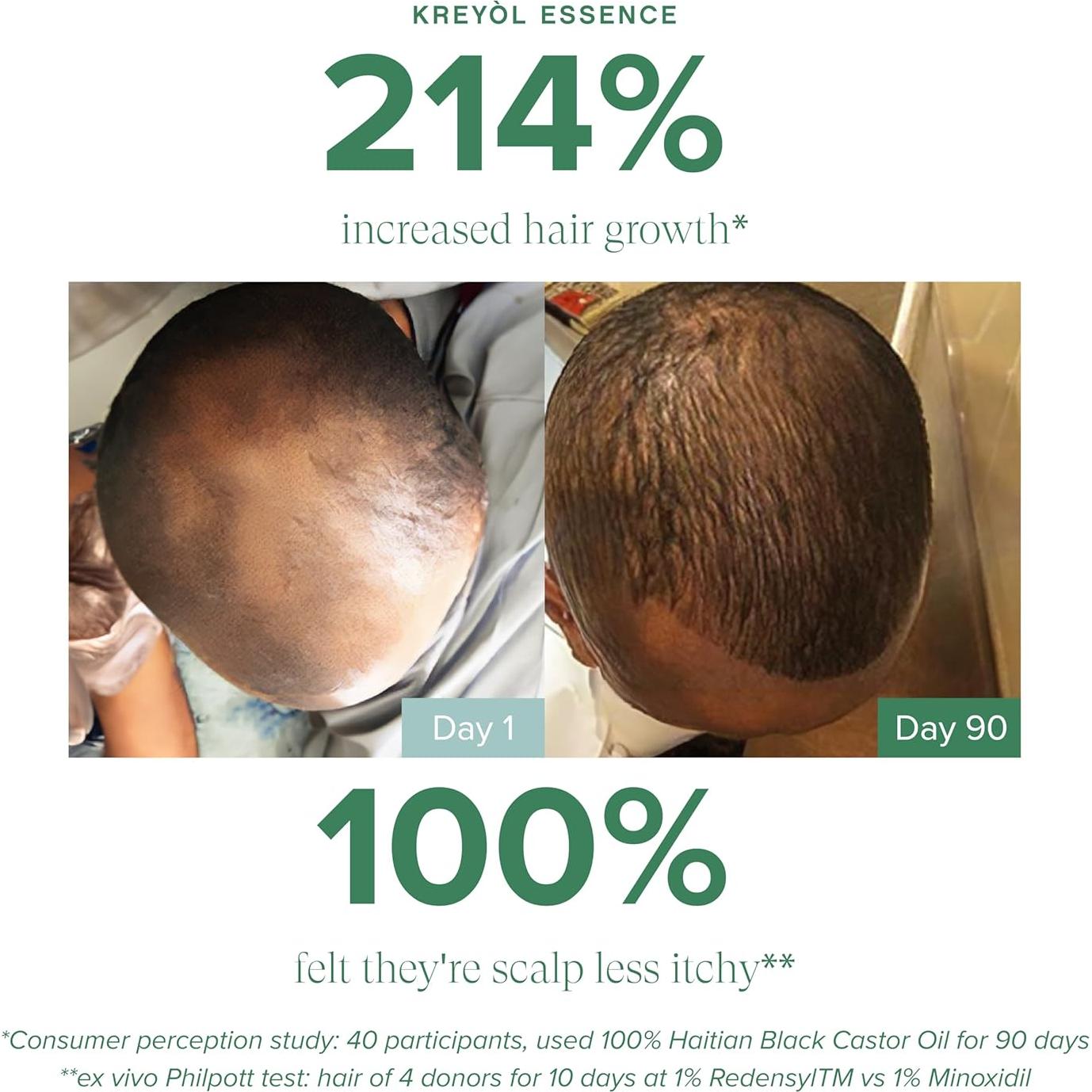 Sérum Capilar Kreyol Essence 48.19 ml - Aceite de Ricino y Redensyl