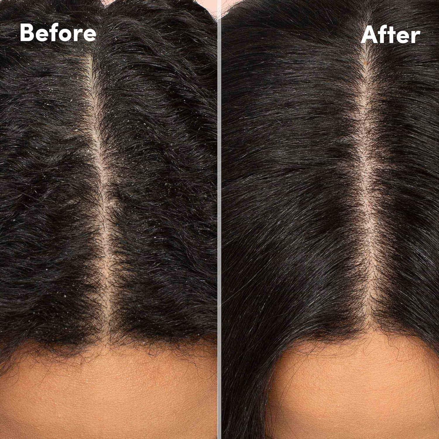 Loción Calmante para Cuero Cabelludo Mizani 132g - Anti Caspa