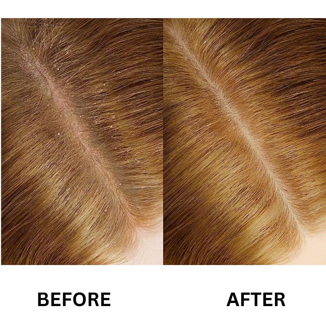 Suero Reparador Anti-Frizz Argyana 30 ml para Cabello Dañado