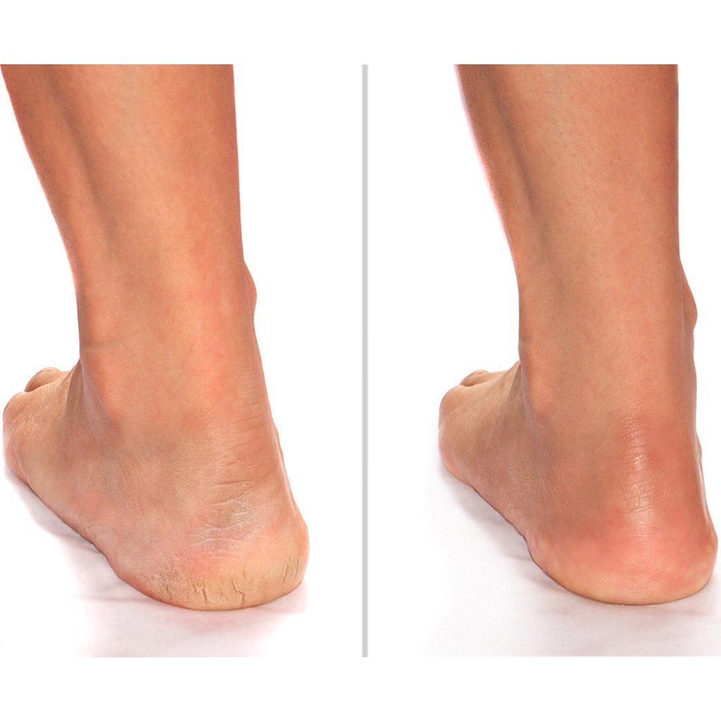 Crema Hidratante para Pies Advanced Clinicals 2 Unidades 500g