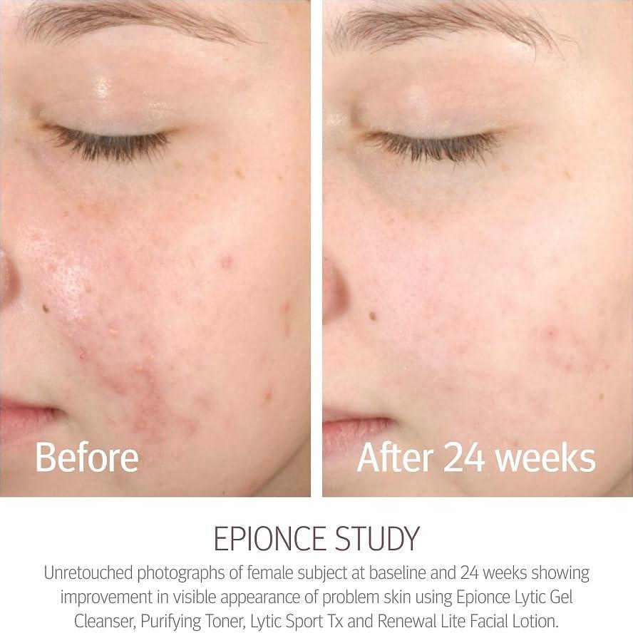 Loción Facial Renovadora Lite Epionce 50ml - Hidratante Anti-Envejecimiento