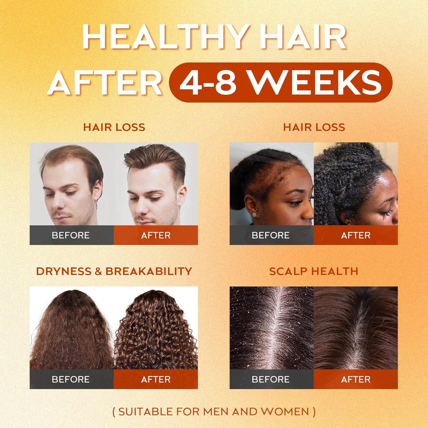 Aceite de Batana Crudo WEEMOTD 120 ml - Crecimiento Cabello