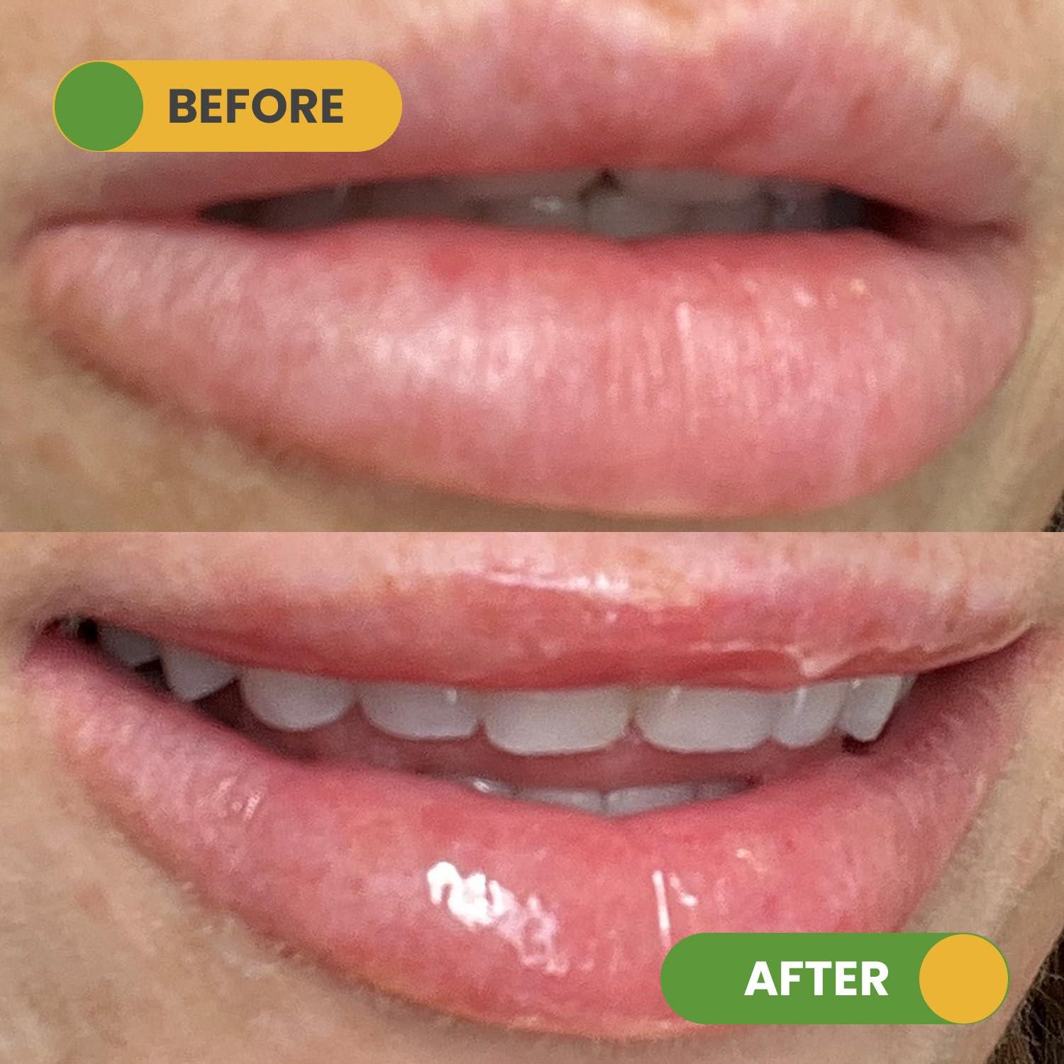 Dúo Labial Hidratante y Exfoliante Nuzilicious - Mango