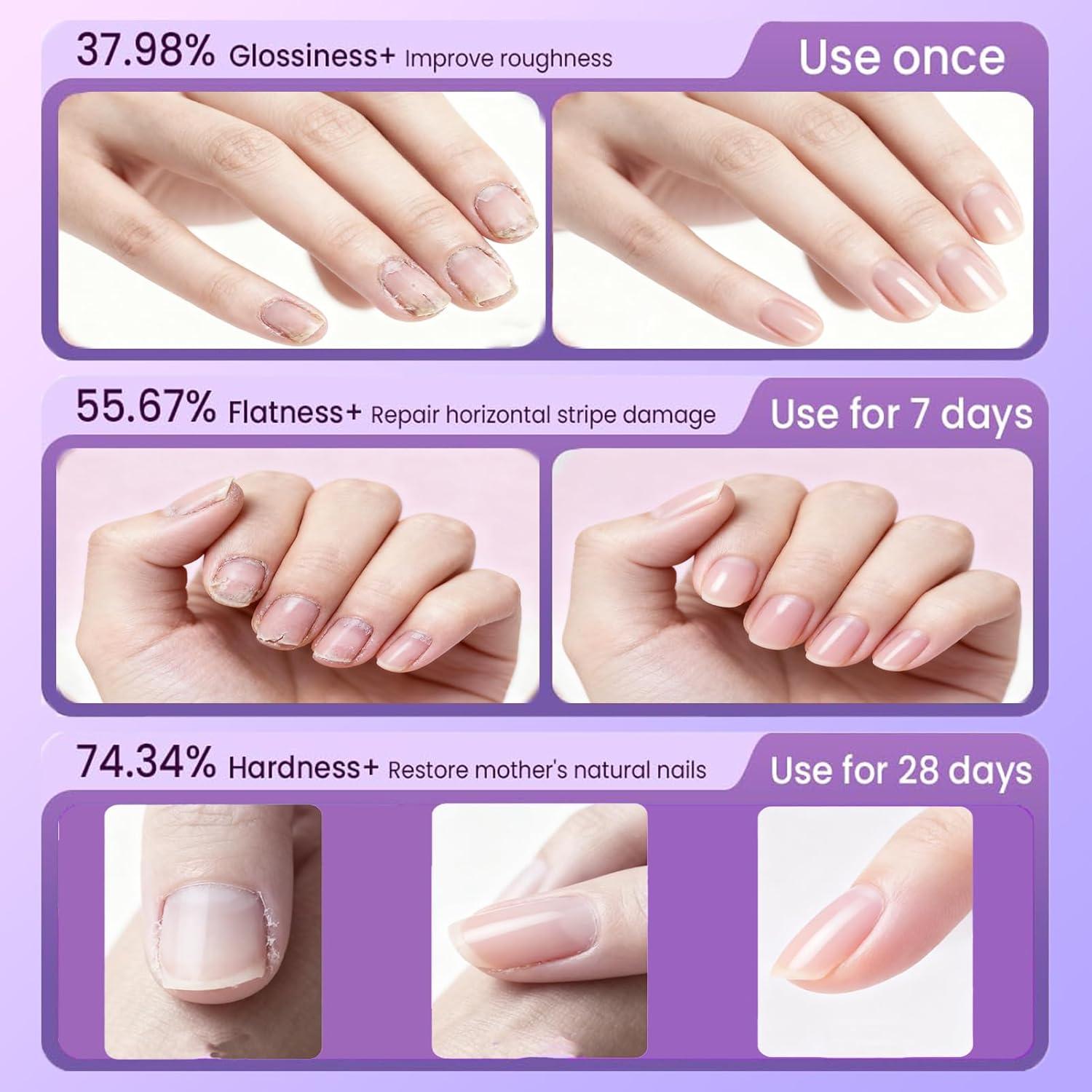 Bolígrafo de Aceite para Cutículas TIUSUTA 3-en-1 con Punta Cerámica