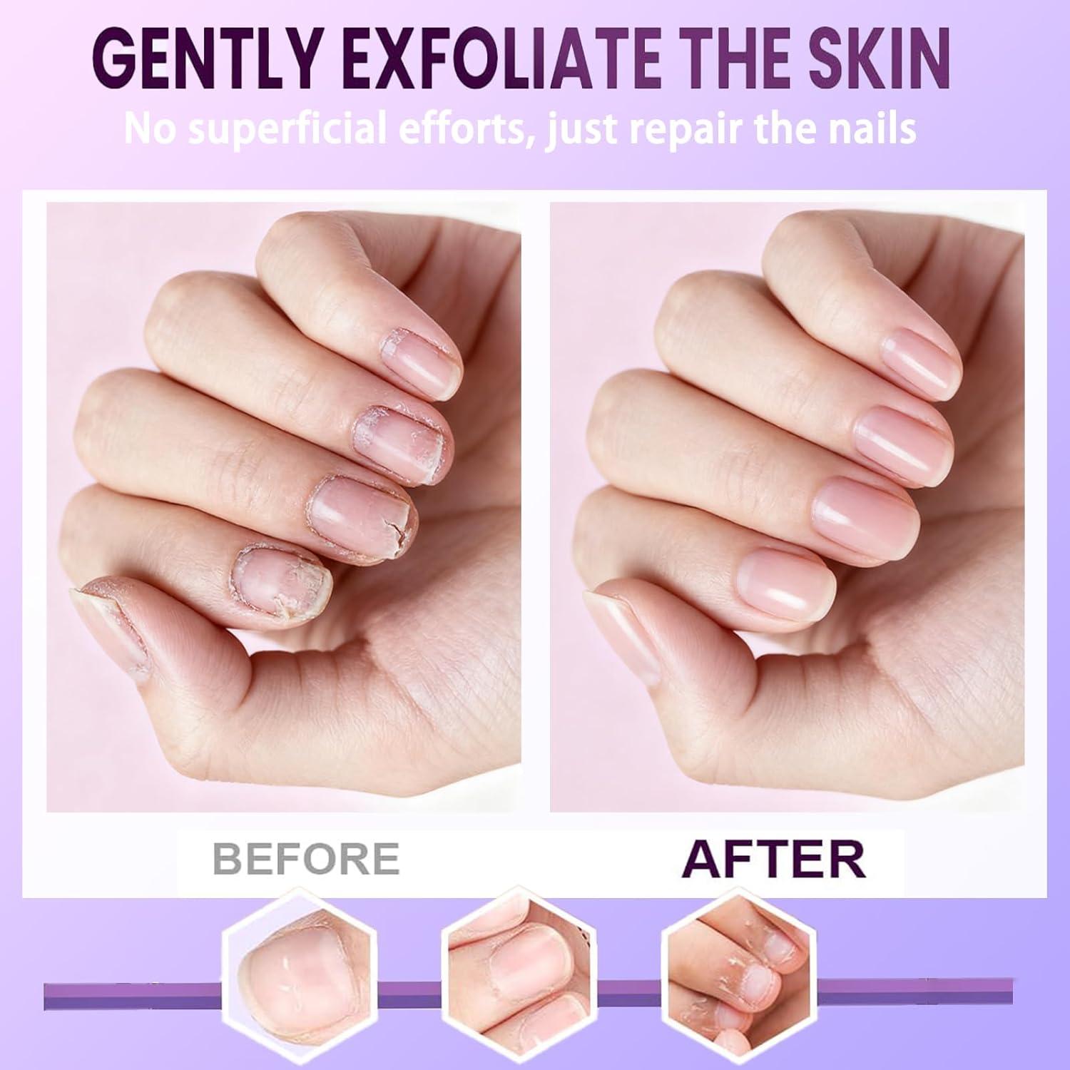 Bolígrafo de Aceite para Cutículas TIUSUTA 3-en-1 con Punta Cerámica