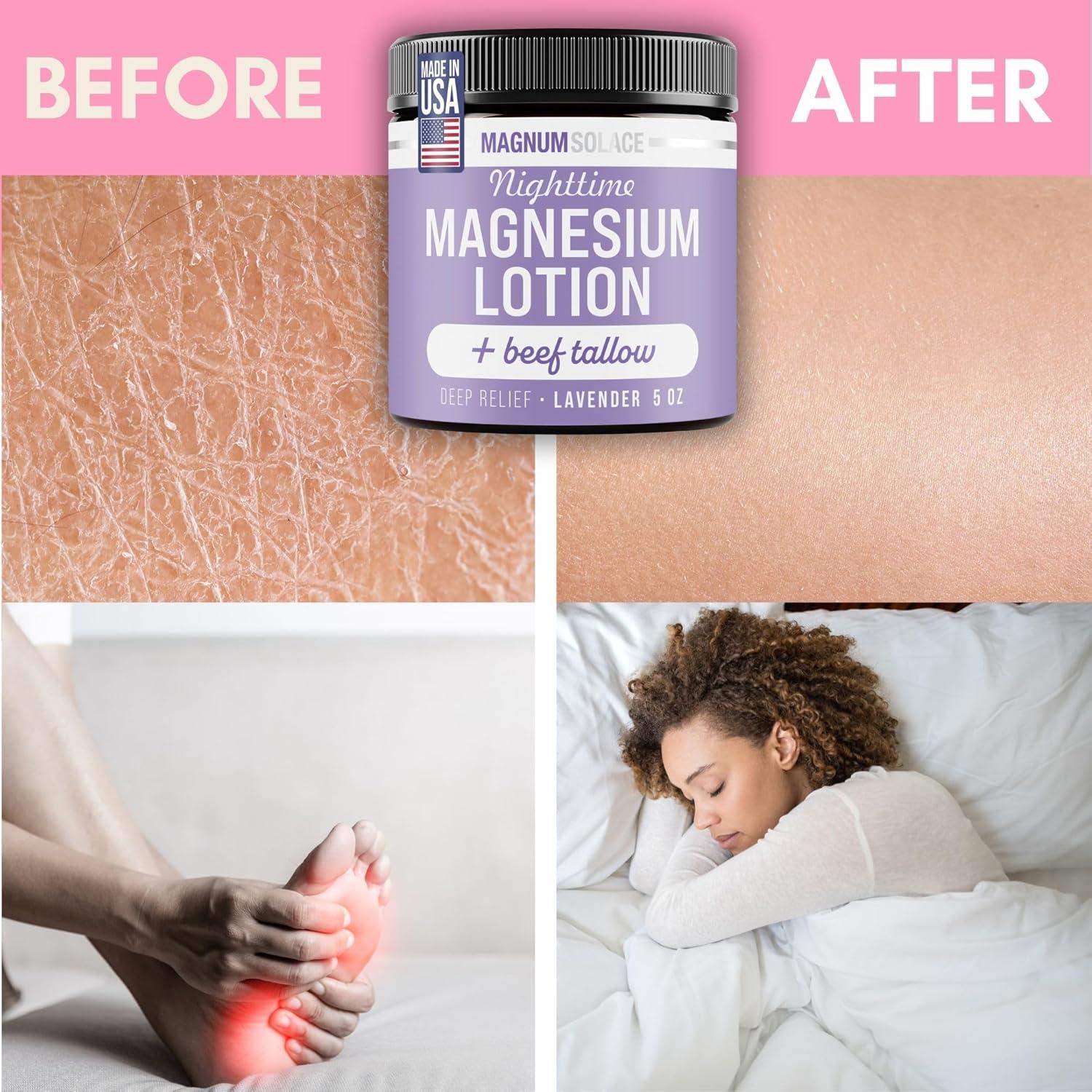 Loción Calmante de Magnesio y Sebo de Res 140g - Magnum Solace