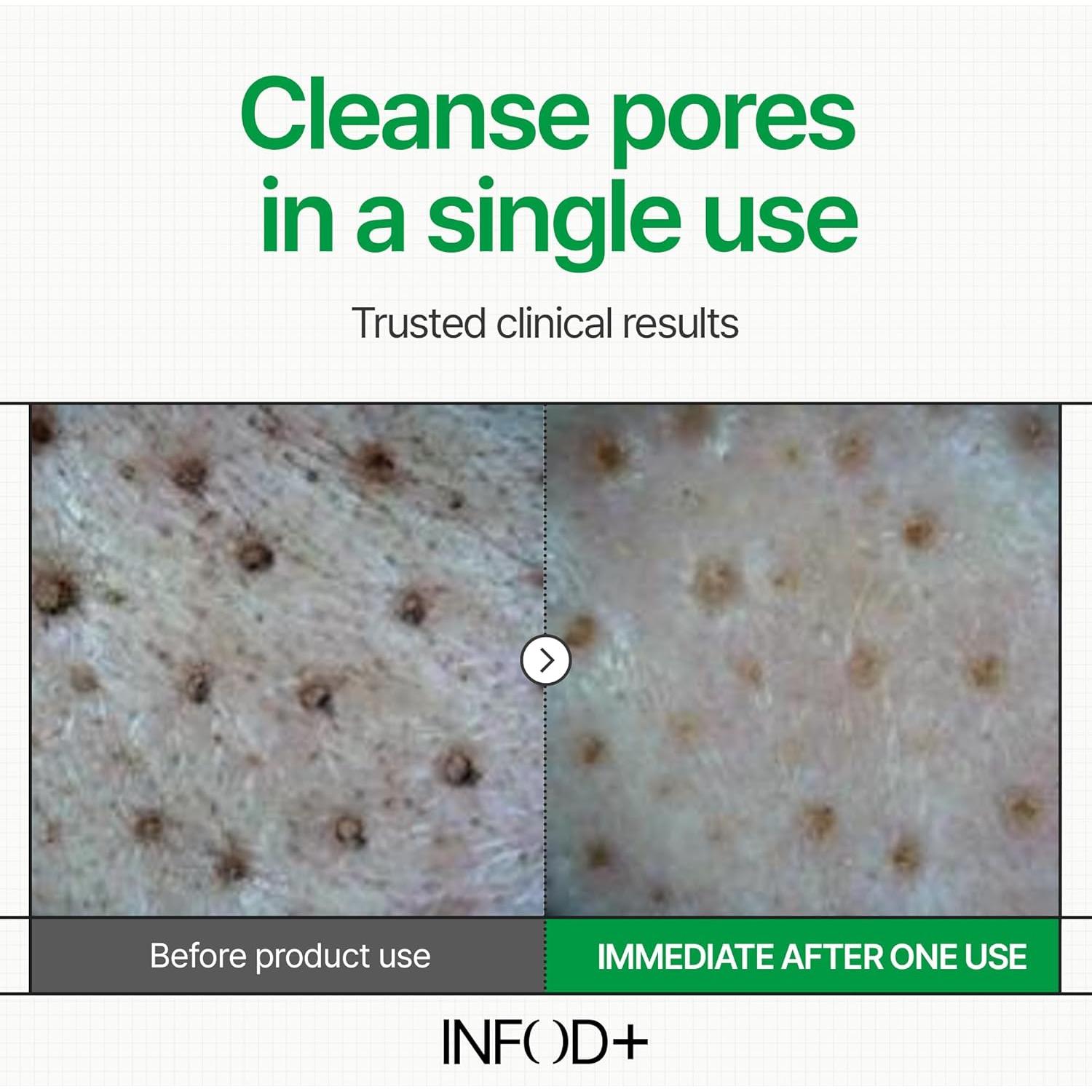 Gel Limpiador Facial Espumoso INFODPLUS XCESPI316 - Exosoma y Nuez