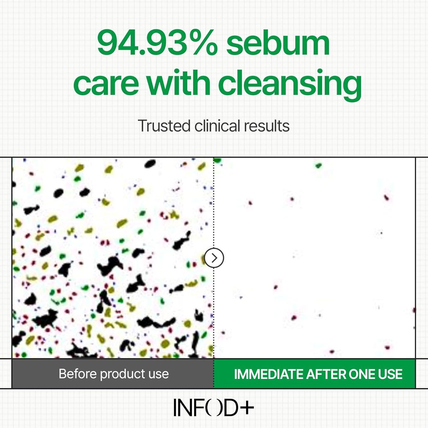 Gel Limpiador Facial Espumoso INFODPLUS XCESPI316 - Exosoma y Nuez