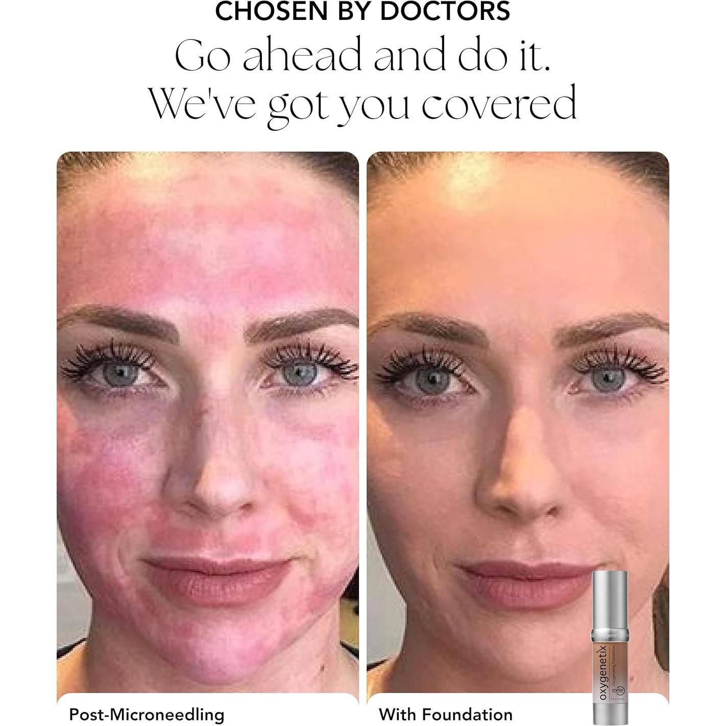 Base Oxigenante Oxygenetix 42g | Maquillaje Transpirable para Piel Sensible