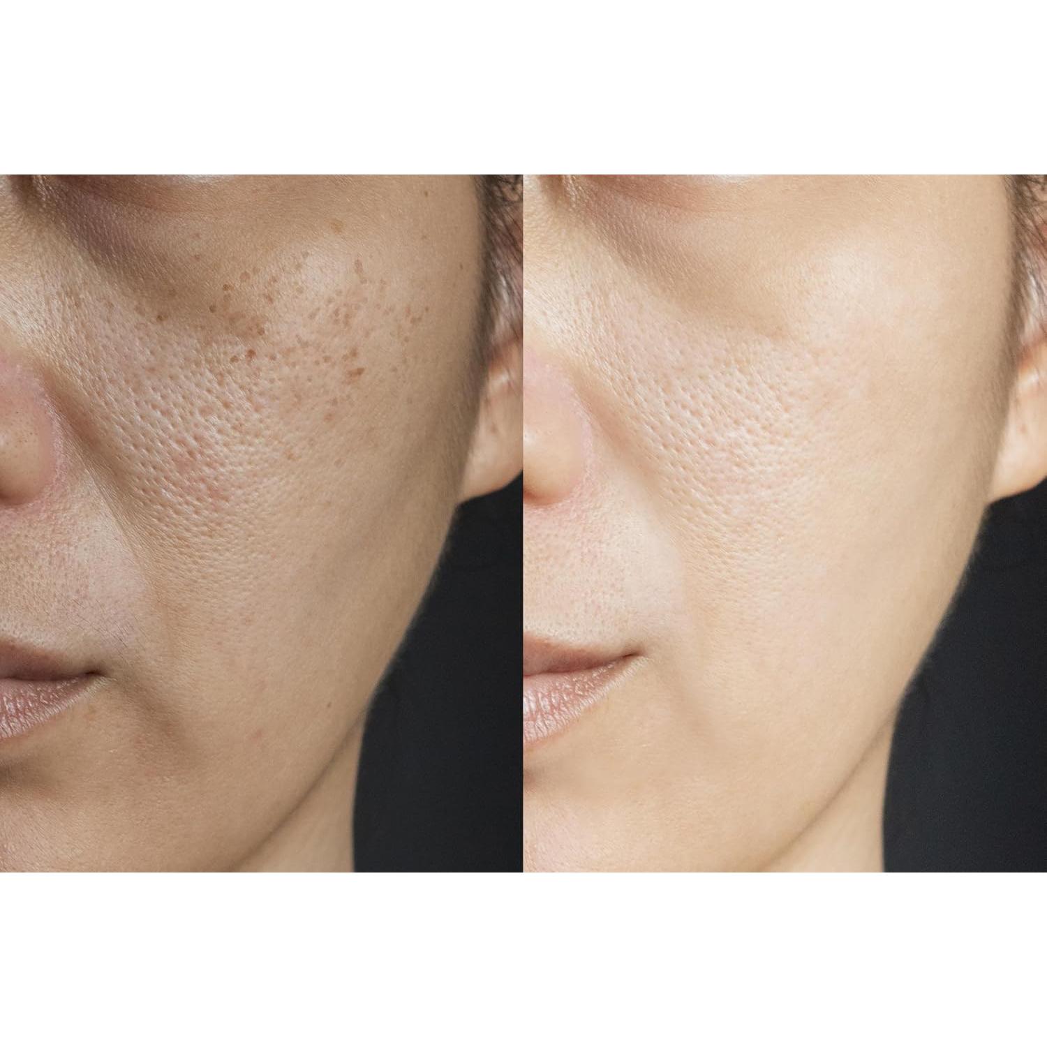 Máscara Enzimática de Calabaza Vitality Precision Skin 167g