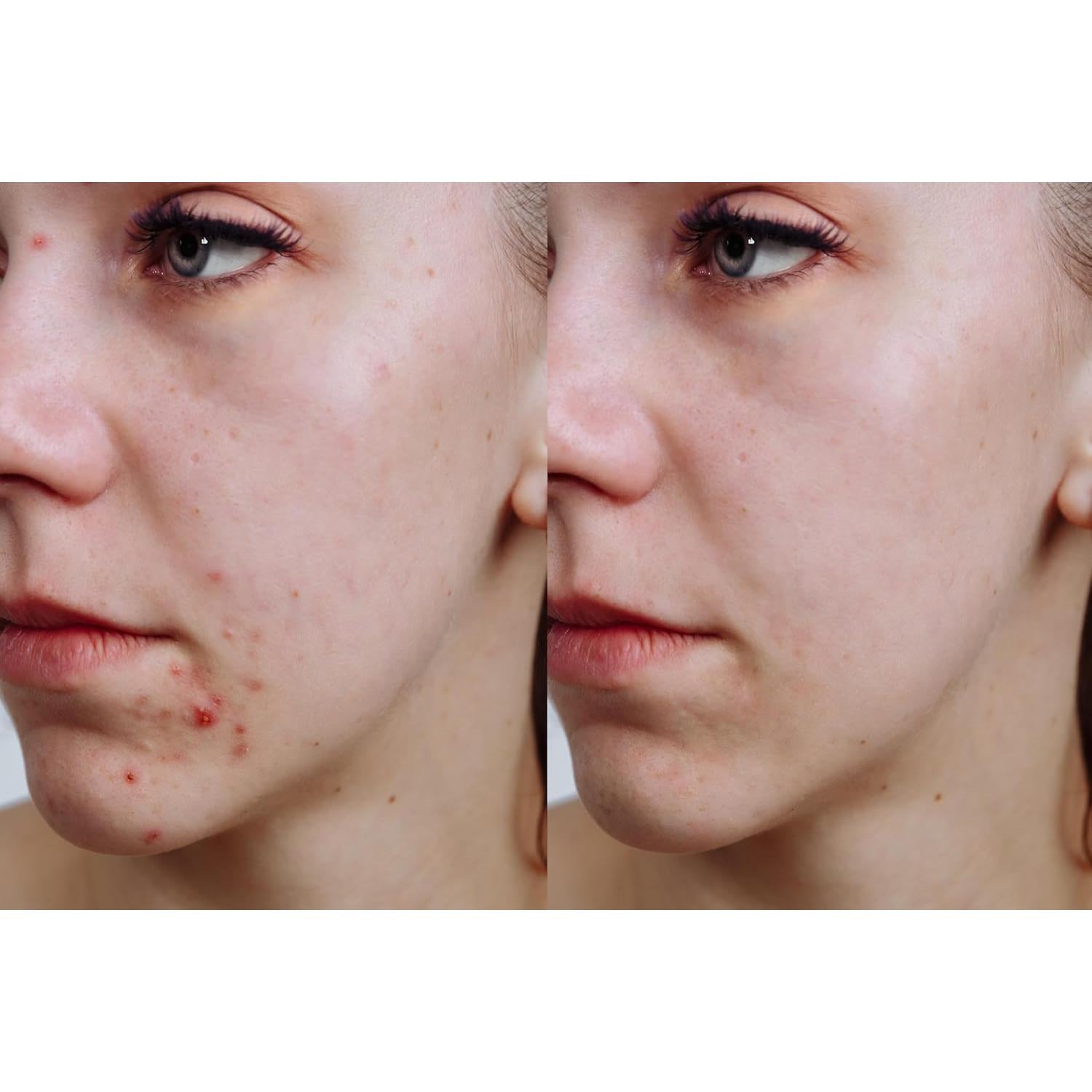 Máscara Enzimática de Calabaza Vitality Precision Skin 167g