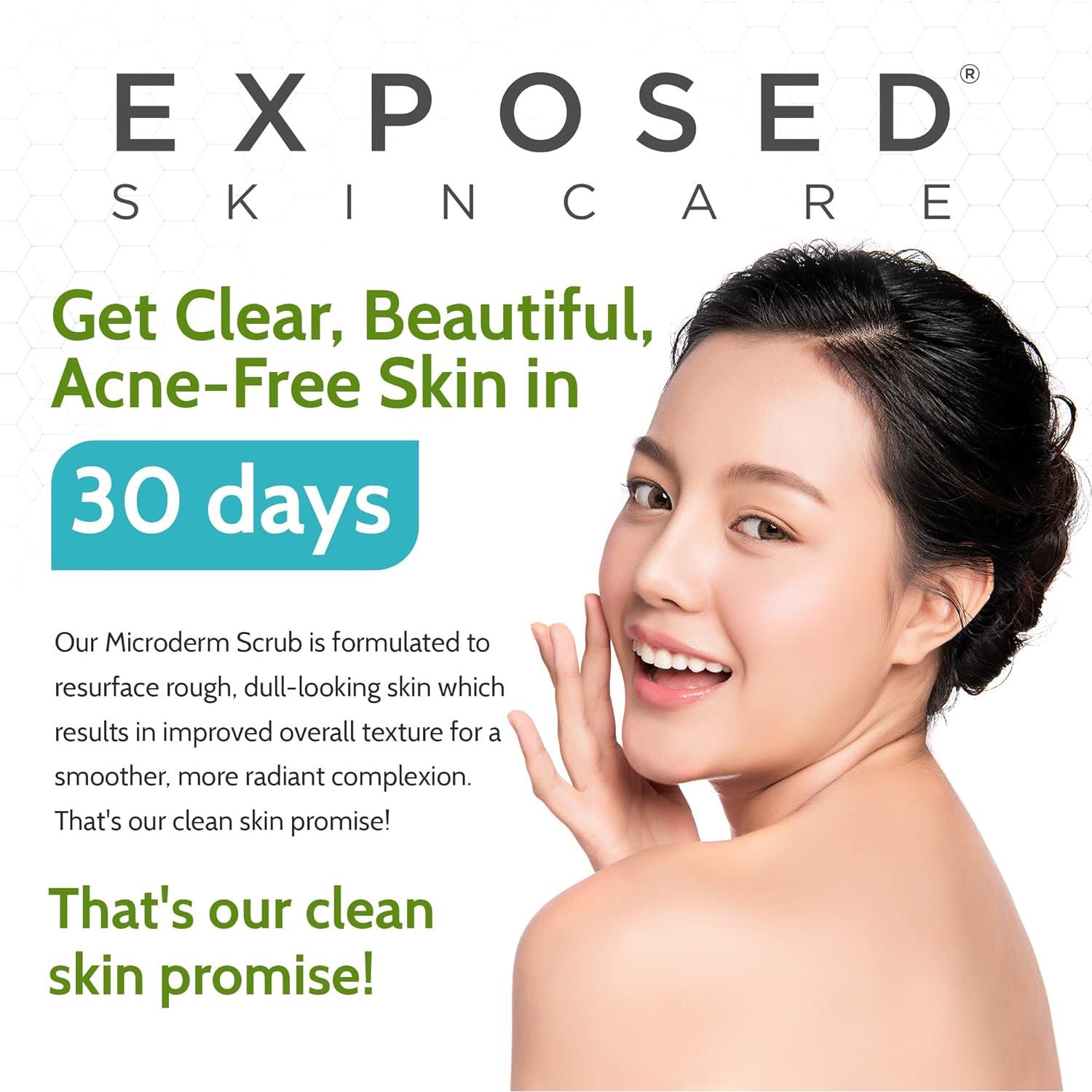 Exfoliante Facial Microderm Exposed Skin Care 48g - Suave para Acné