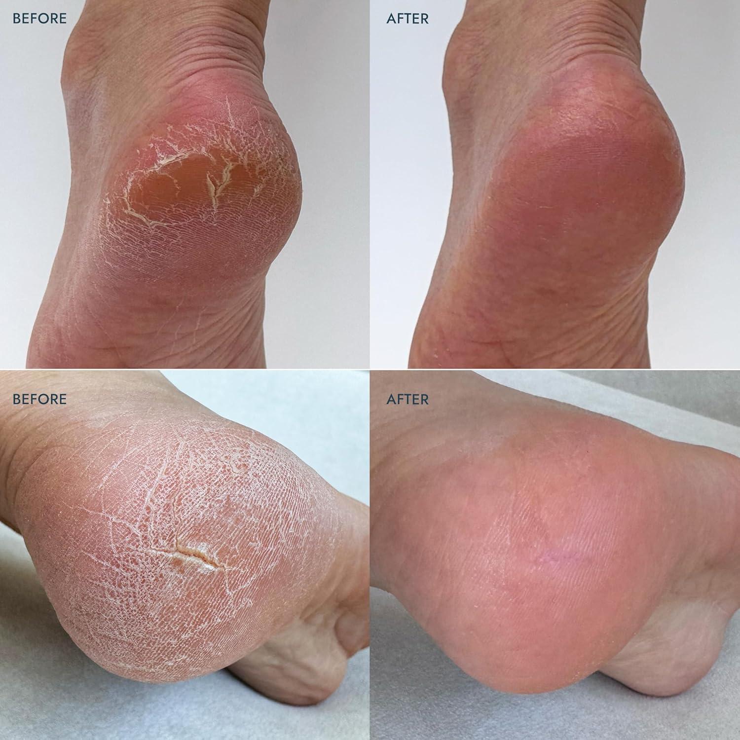 Bálsamo Reparador de Talones VOESH 59g Hidratante Lavanda