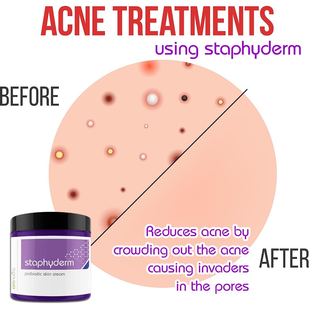 Spray Probiotico Staphyderm 60ml Cuidado Piel Luchadores