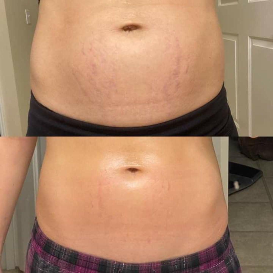 Crema Bum Bum IT 226.8g - Reafirmante y Elevadora para Celulitis