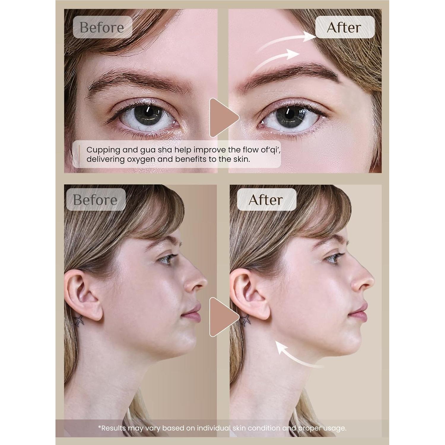 Set de Ventosas Faciales Rena Chris con Gua Sha Cuarzo Rosa