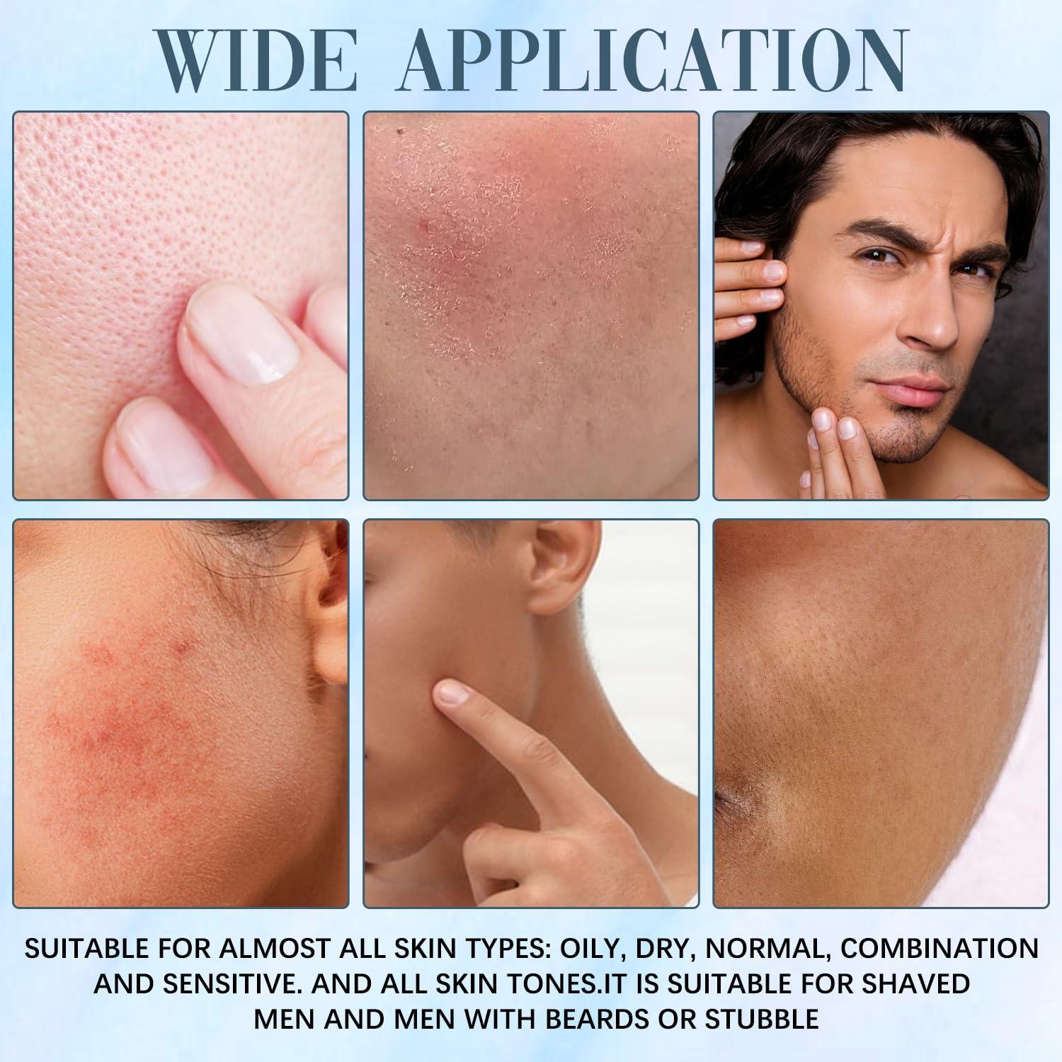 Set de Cuidado de Piel MuKuns para Eliminar Acné - 3 Piezas