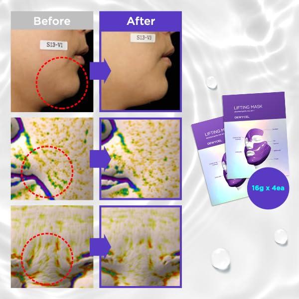 Mascarilla Lifting Hidratante DEWYCEL 7 Puntos HydroGel 4 Unidades