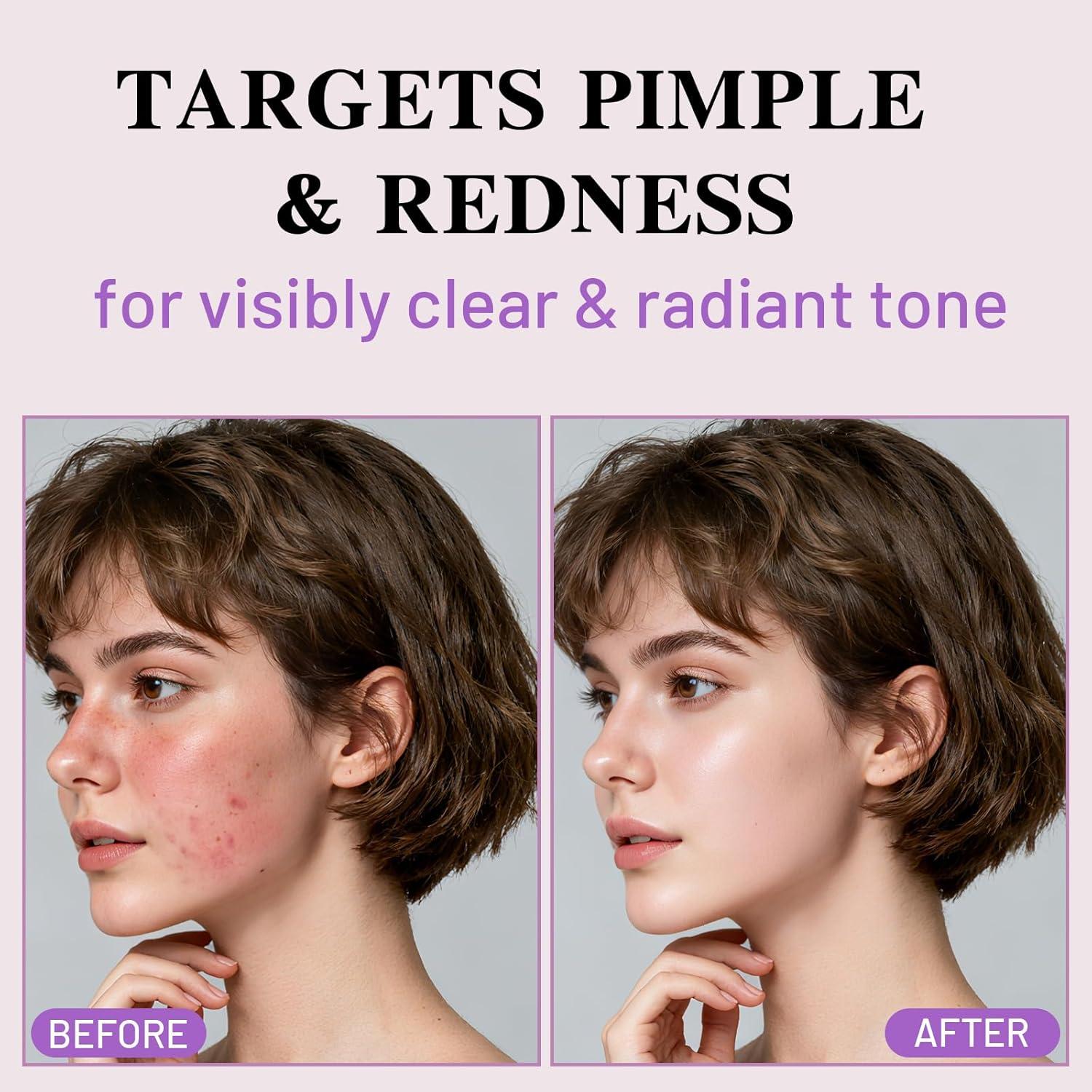 Mascarilla Facial Hidratante Meizhuangzhiku - 4 Paquetes 204g