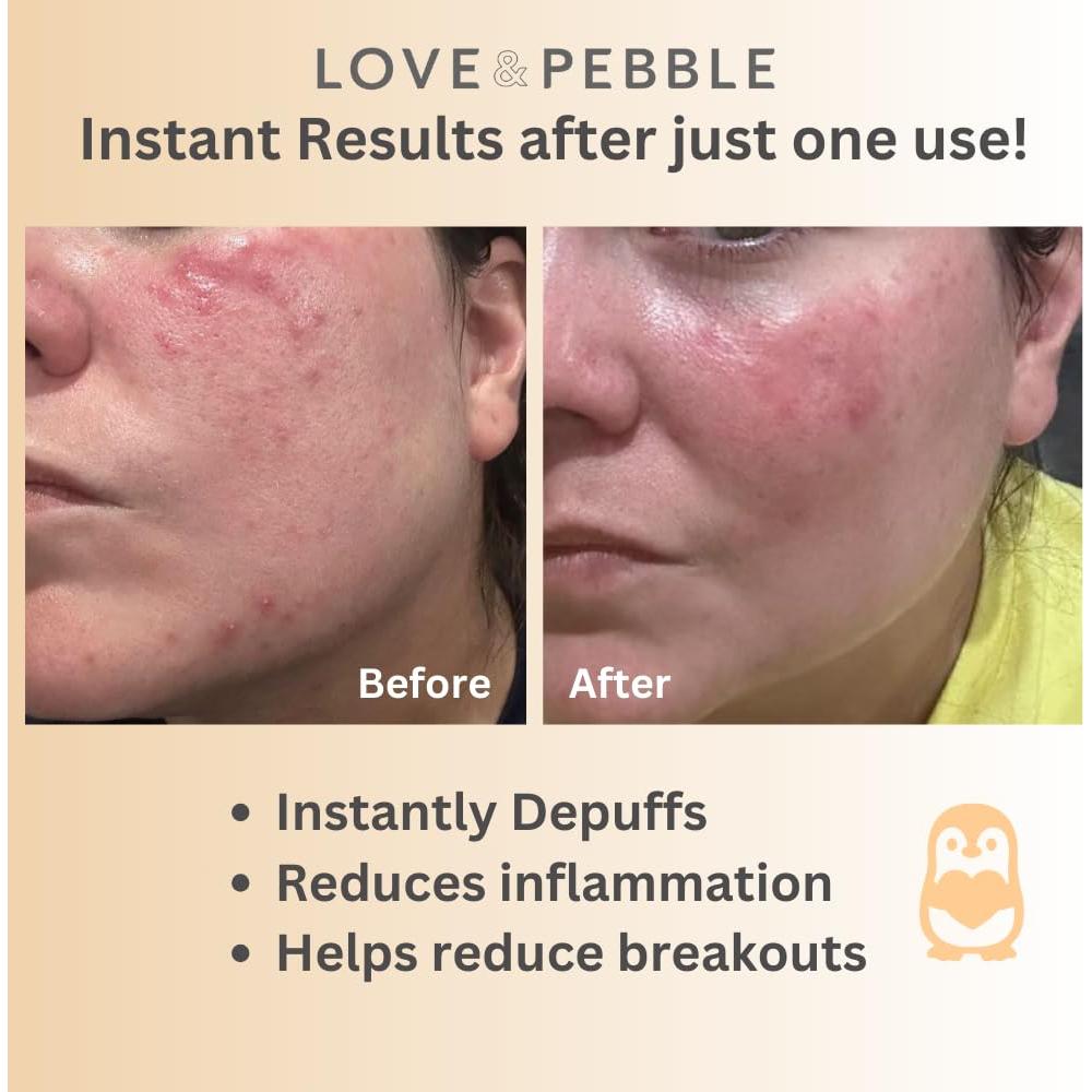 Rodillo de Hielo Love & Pebble con Máscara Facial de Superalimentos