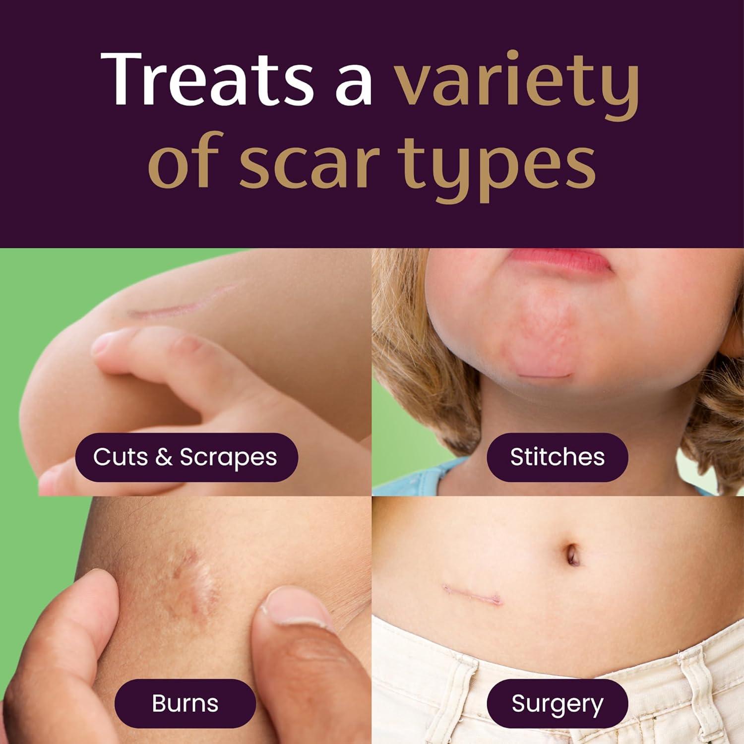 Gel para Cicatrices Mederma Niños 19.84 g - Aroma Uva