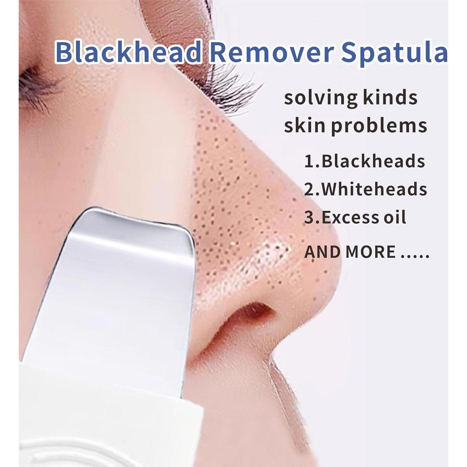 Juego de Herramientas para Puntos Negros REVEX - 2 Piezas