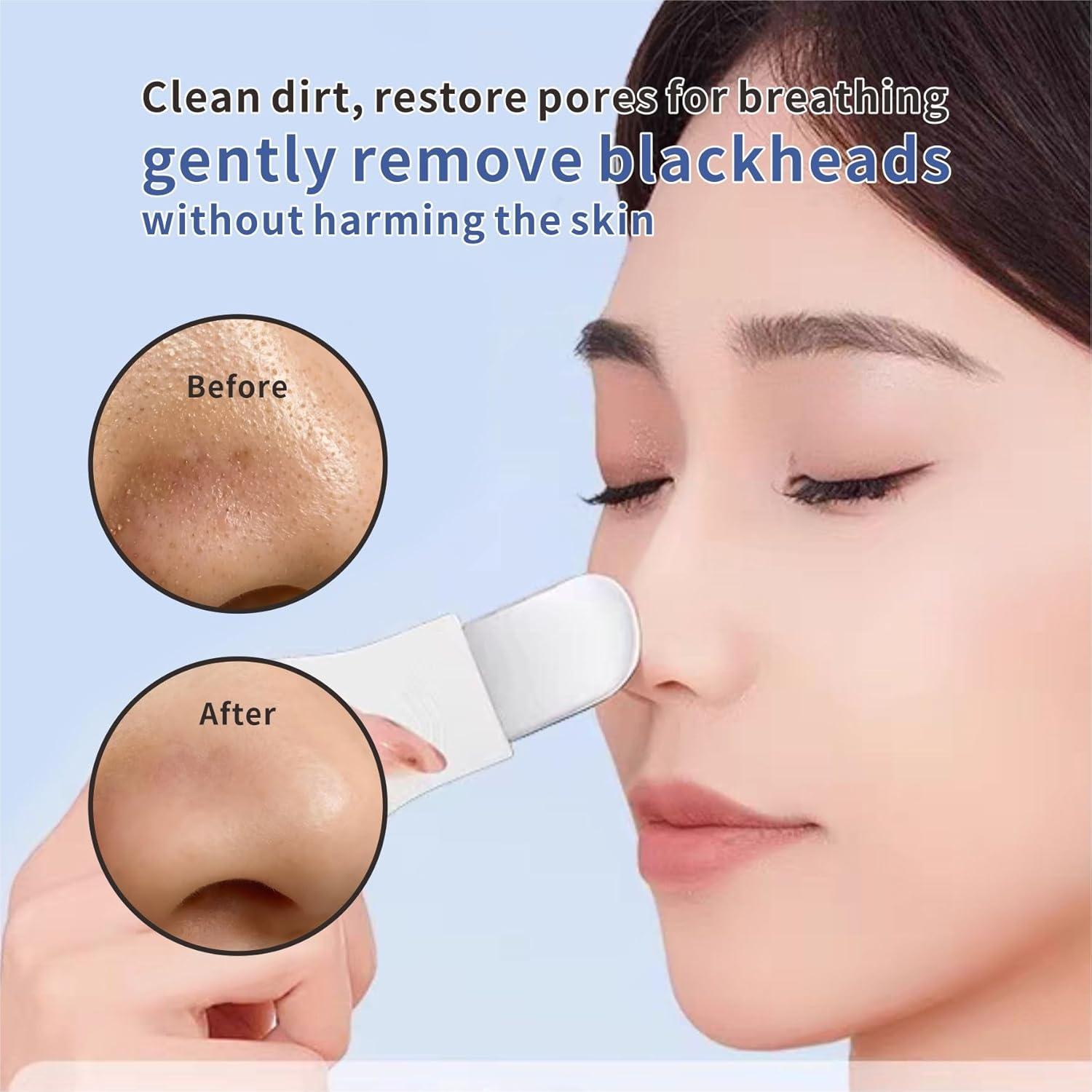 Juego de Herramientas para Puntos Negros REVEX - 2 Piezas