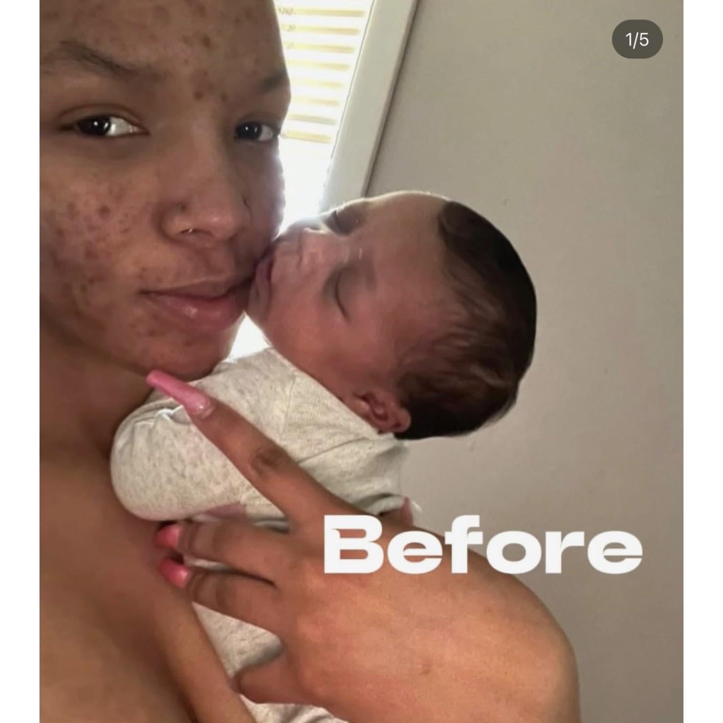 Barra de Belleza Dripglosss con Cúrcuma 113.4 g - Aclara y Alivia