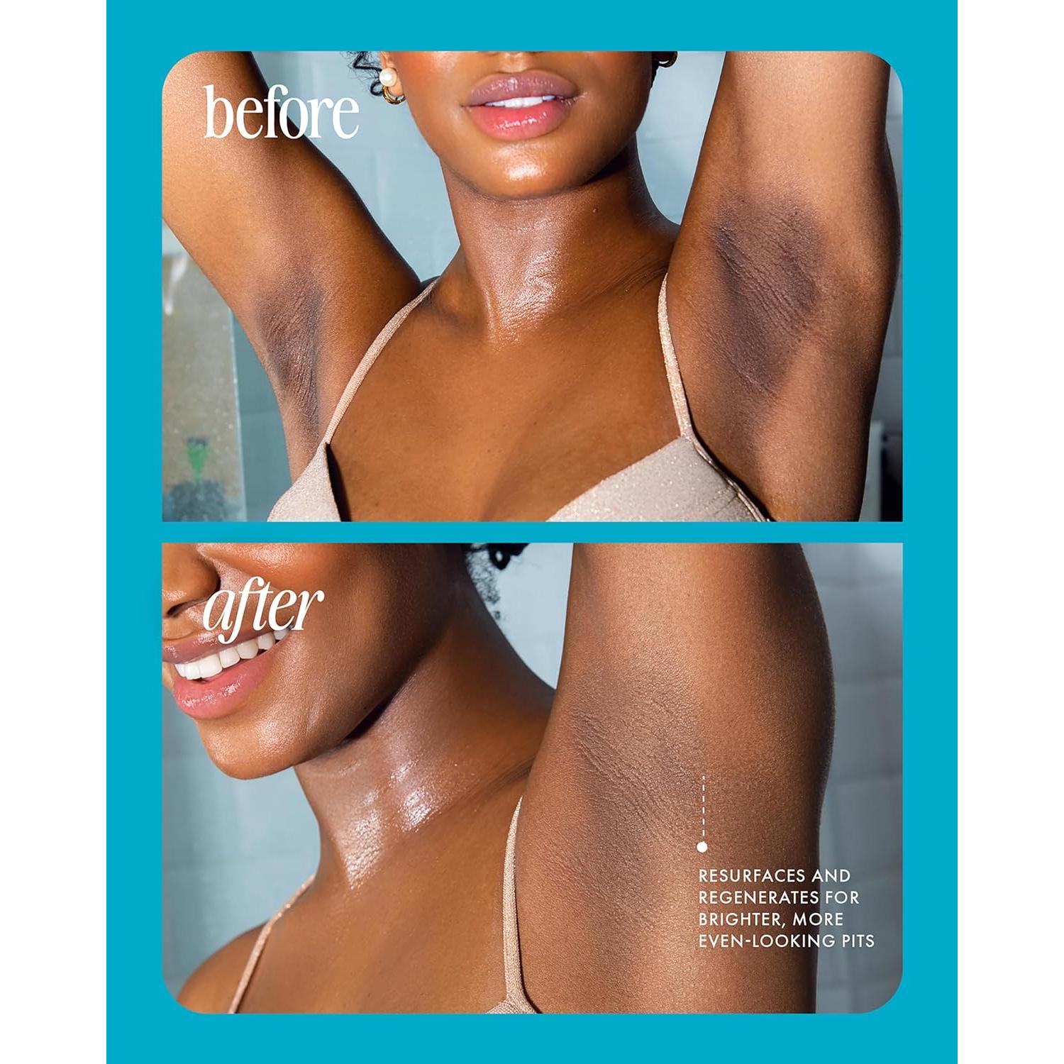 Suero Jelly Booster Truly Beauty 87.9 g - Tratamiento Cicatrices