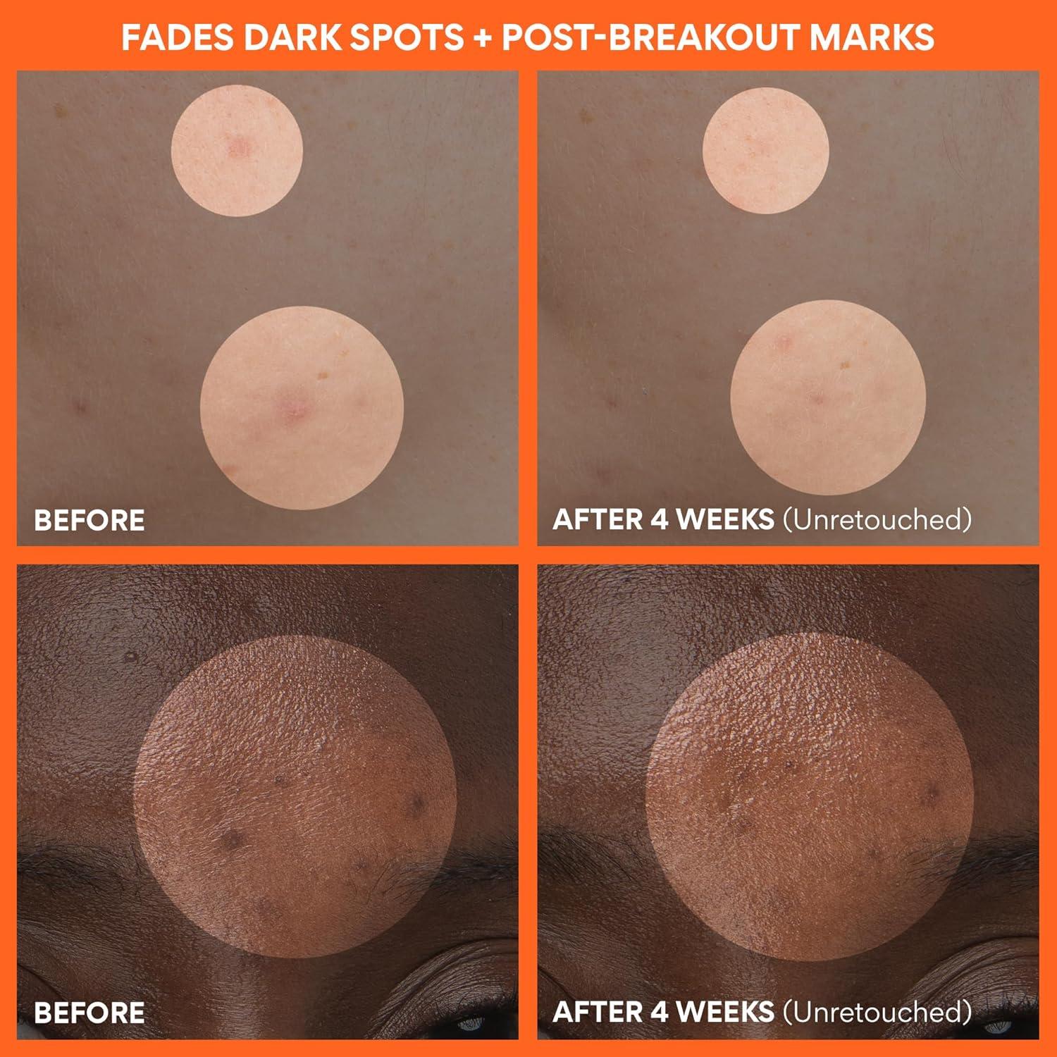 Crema Iluminadora de Vitamina C innisfree 50ml - Hidratante Facial