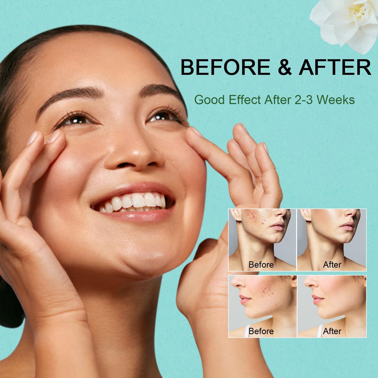 Mascarilla Limpiadora Profunda de Té Verde Lisara 2PCS 40.5g