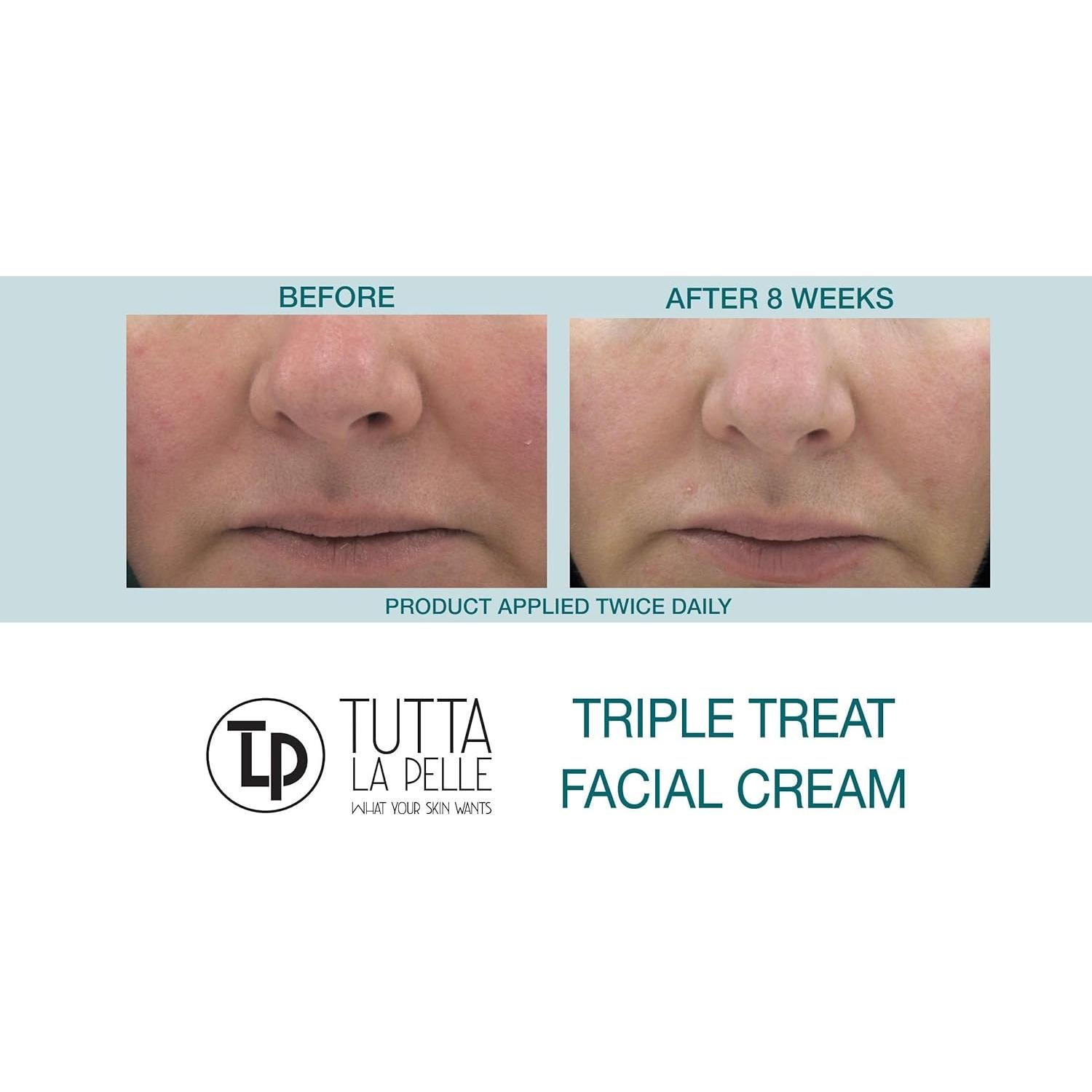 Crema Facial Anti Envejecimiento Tutta La Pelle 28g - Triple Tratamiento