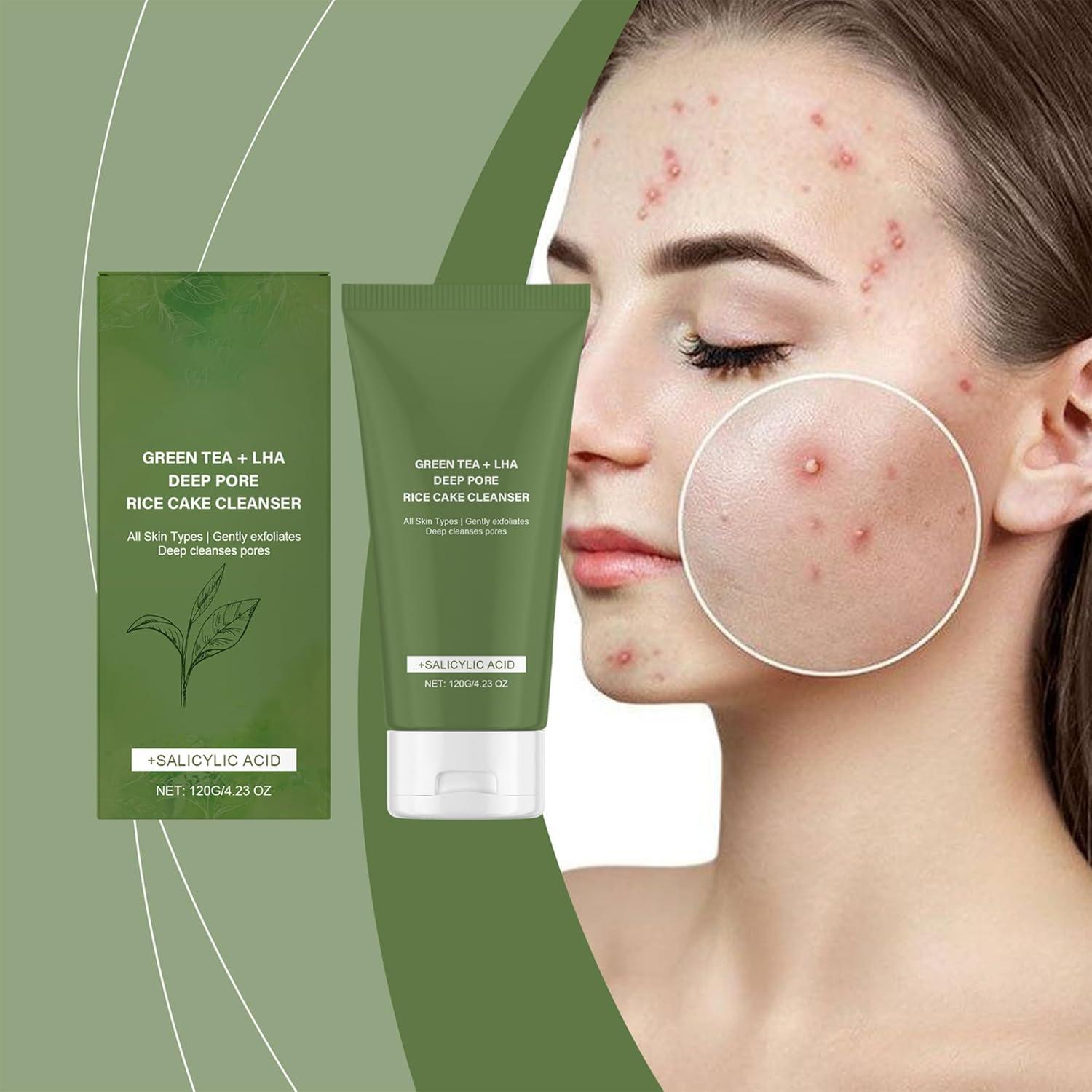 Limpiador Facial de Té Verde Flobow 117g - Piel Grasa y Acné