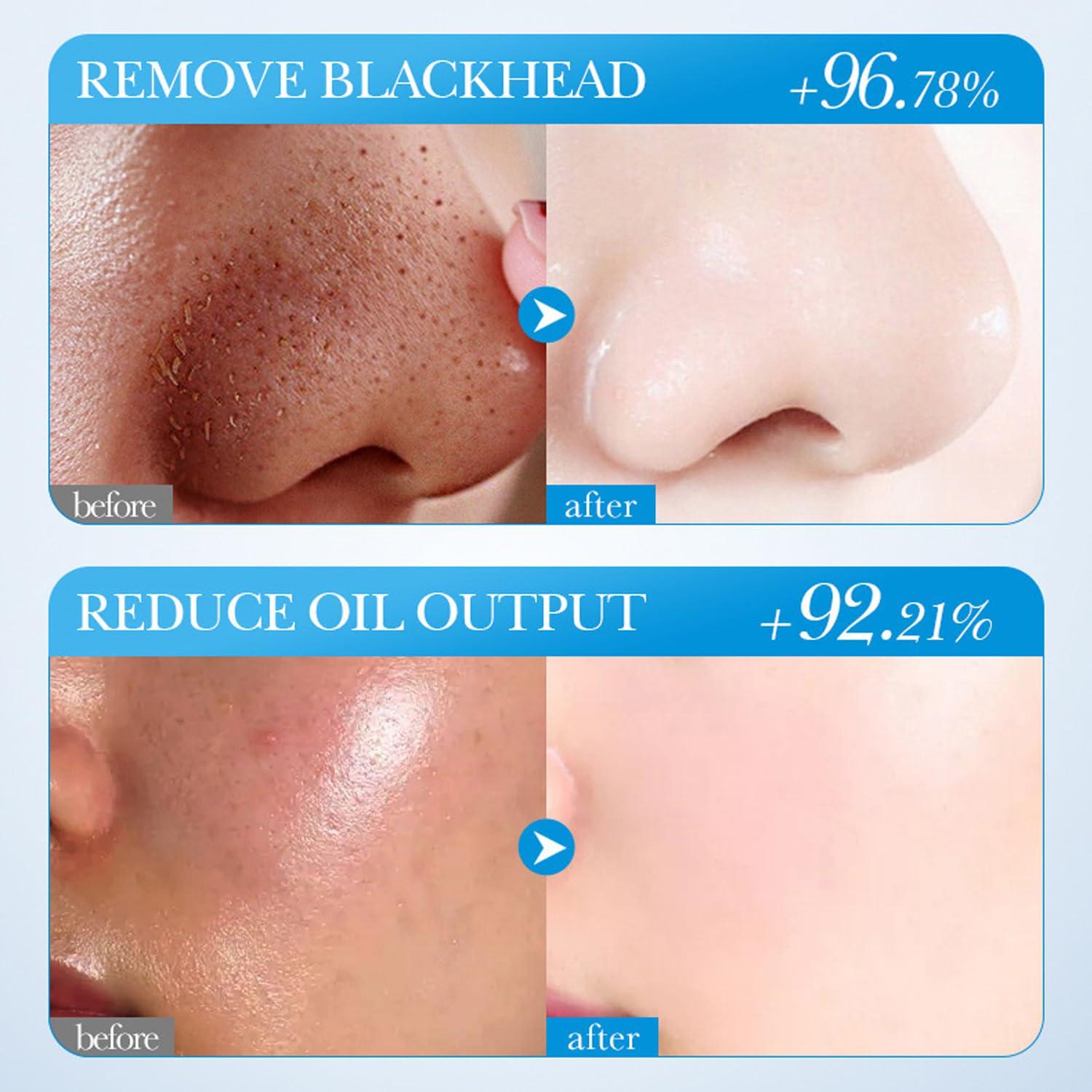 Mascarilla Facial de Té Verde y Cúrcuma Blopuivo - 3 Piezas