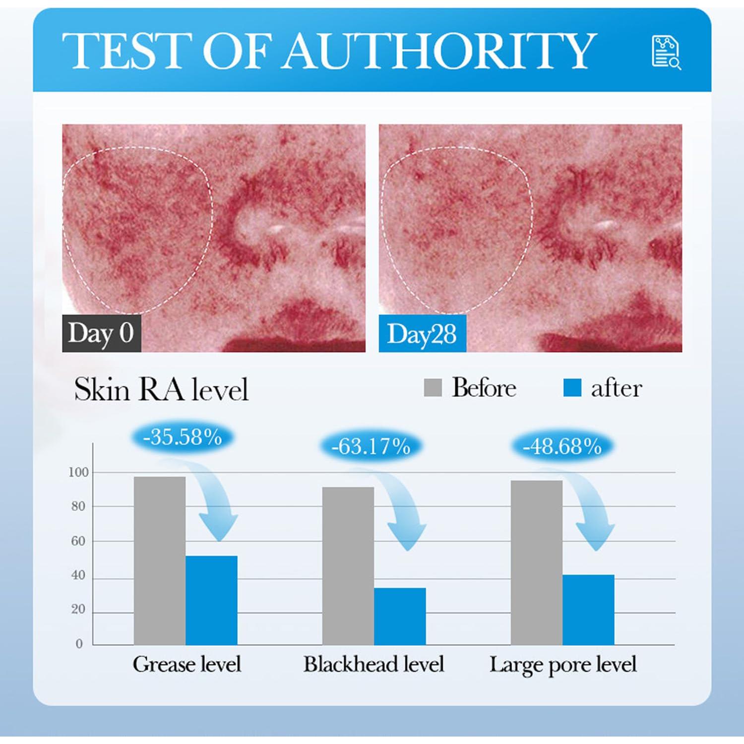 Mascarilla Facial de Té Verde y Cúrcuma Blopuivo - 3 Piezas