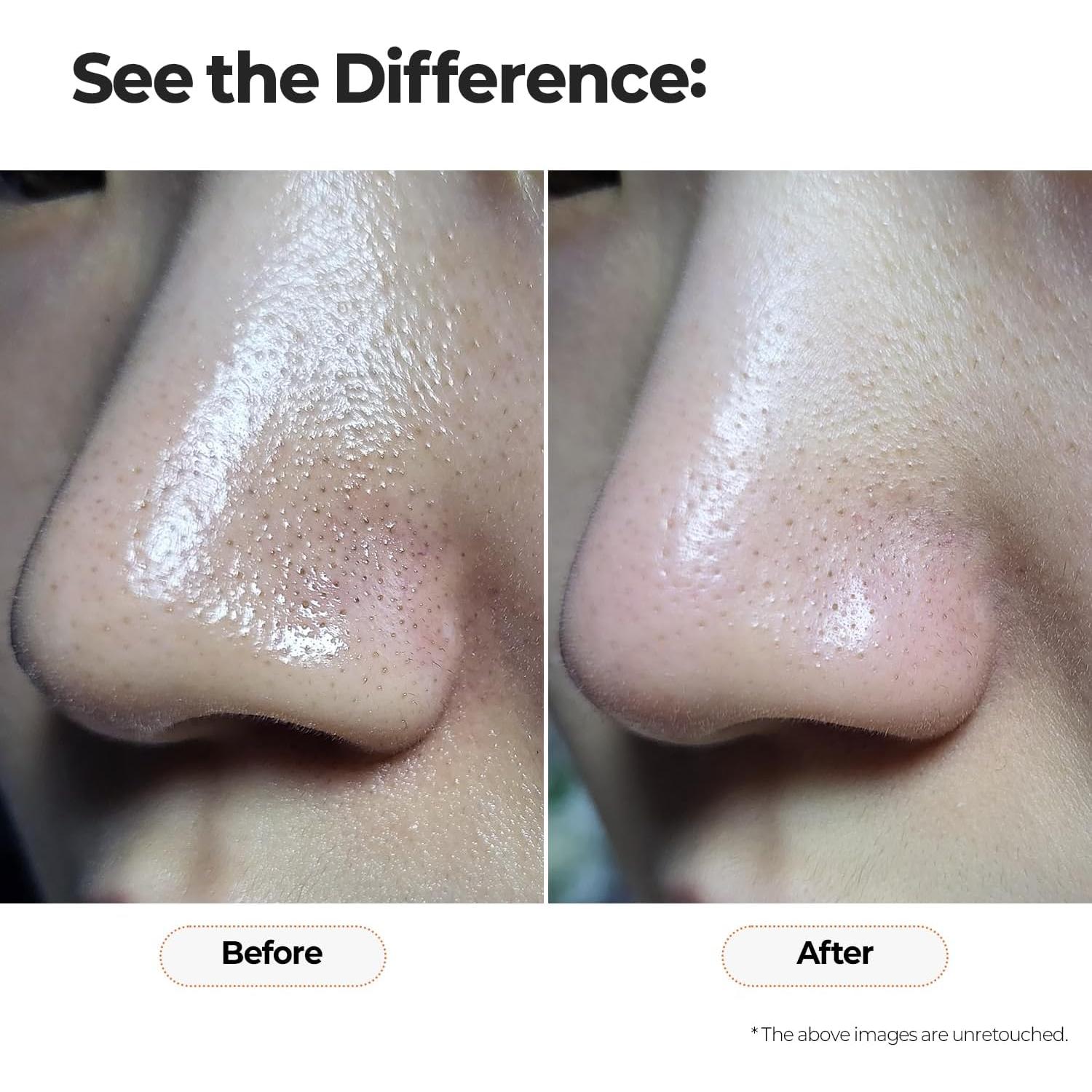 Tónico Facial Clarificante MOTHER MADE Té Verde 150 ml AHA BHA PHA