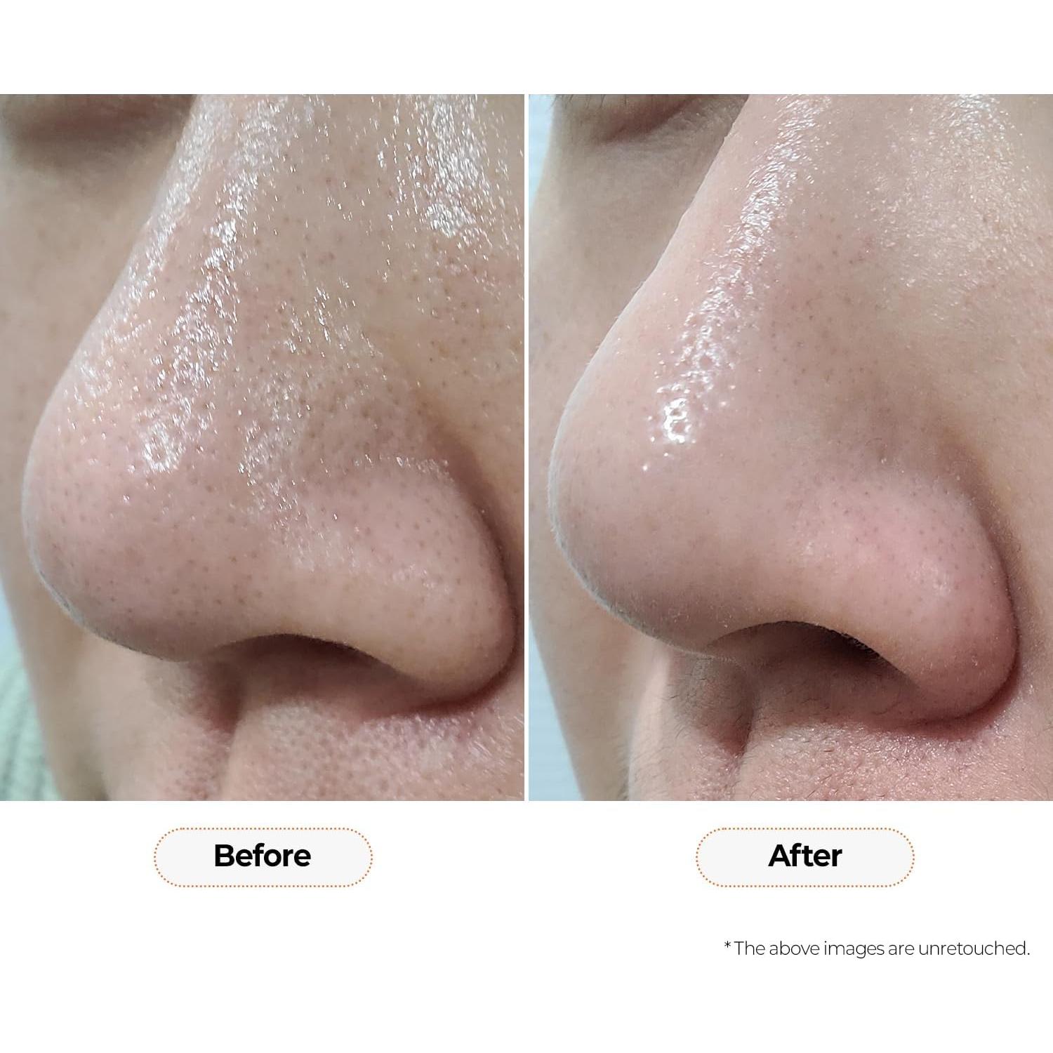 Tónico Facial Clarificante MOTHER MADE Té Verde 150 ml AHA BHA PHA