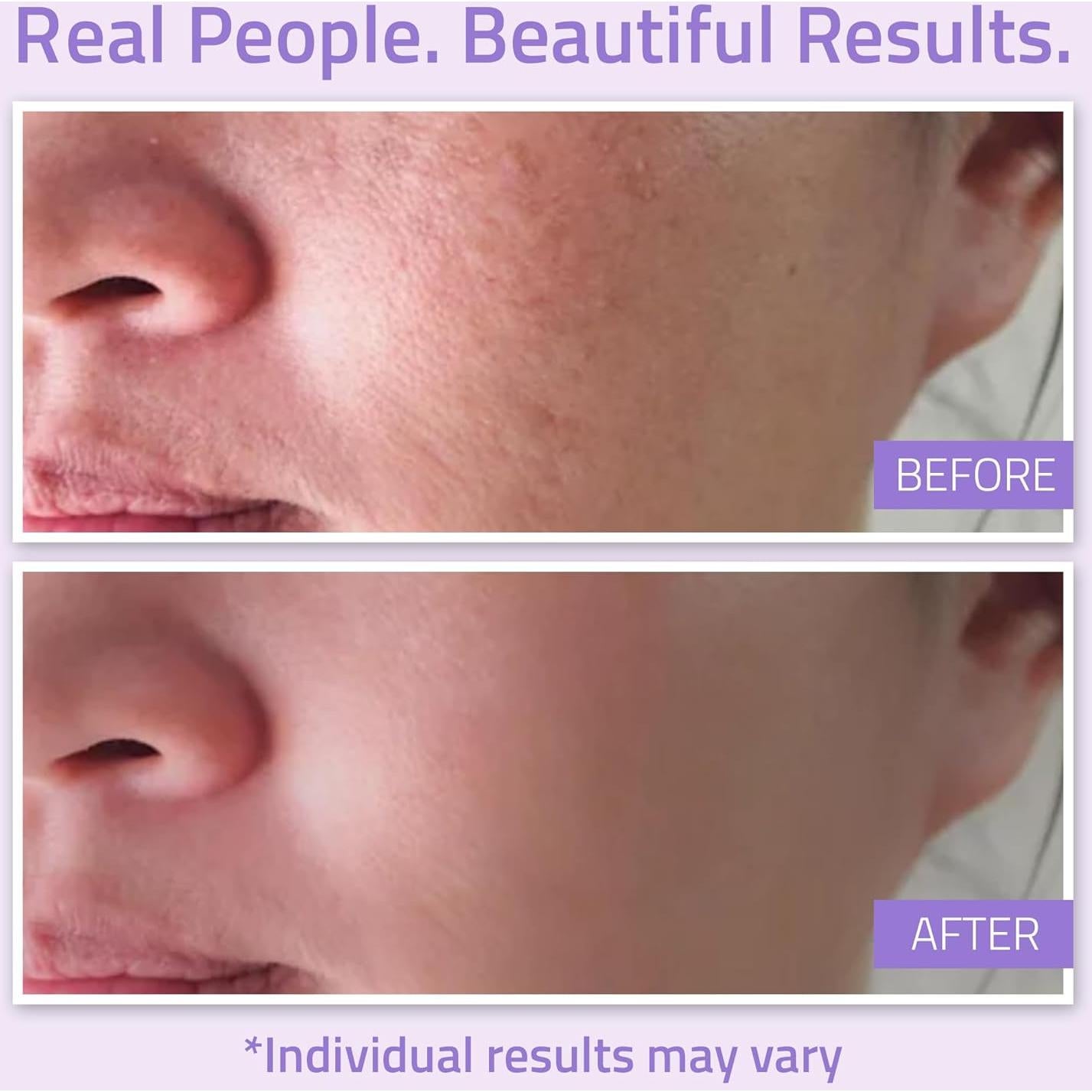 Tónico Hidratante Facial YEOUTH 100 ml con Manzanilla y Alantoína