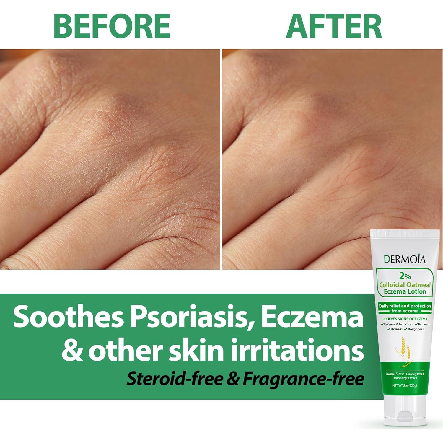 Loción de Avena Coloidal 2% Dermoia 227g - Hidratante Eccema