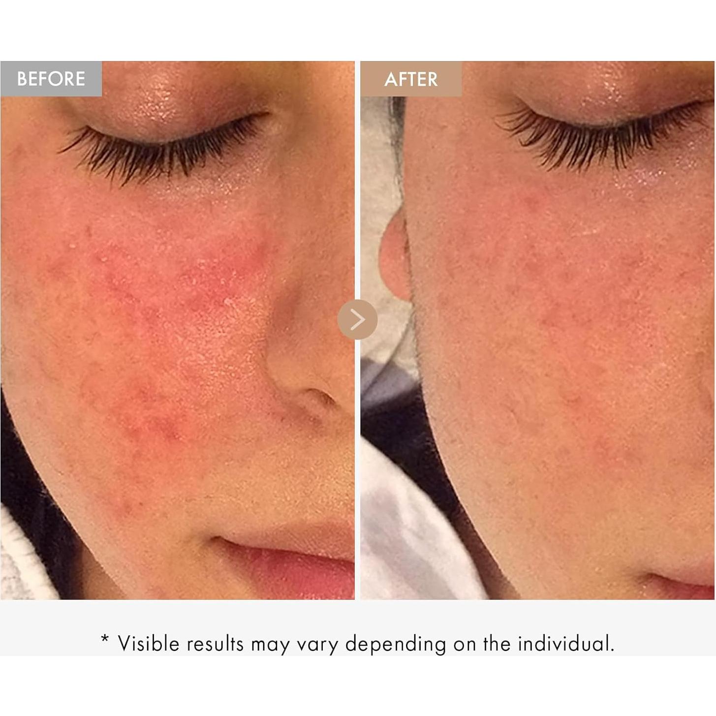 Crema de Alivio de Avena Real TOSOWOONG 50ml Hidratante Facial