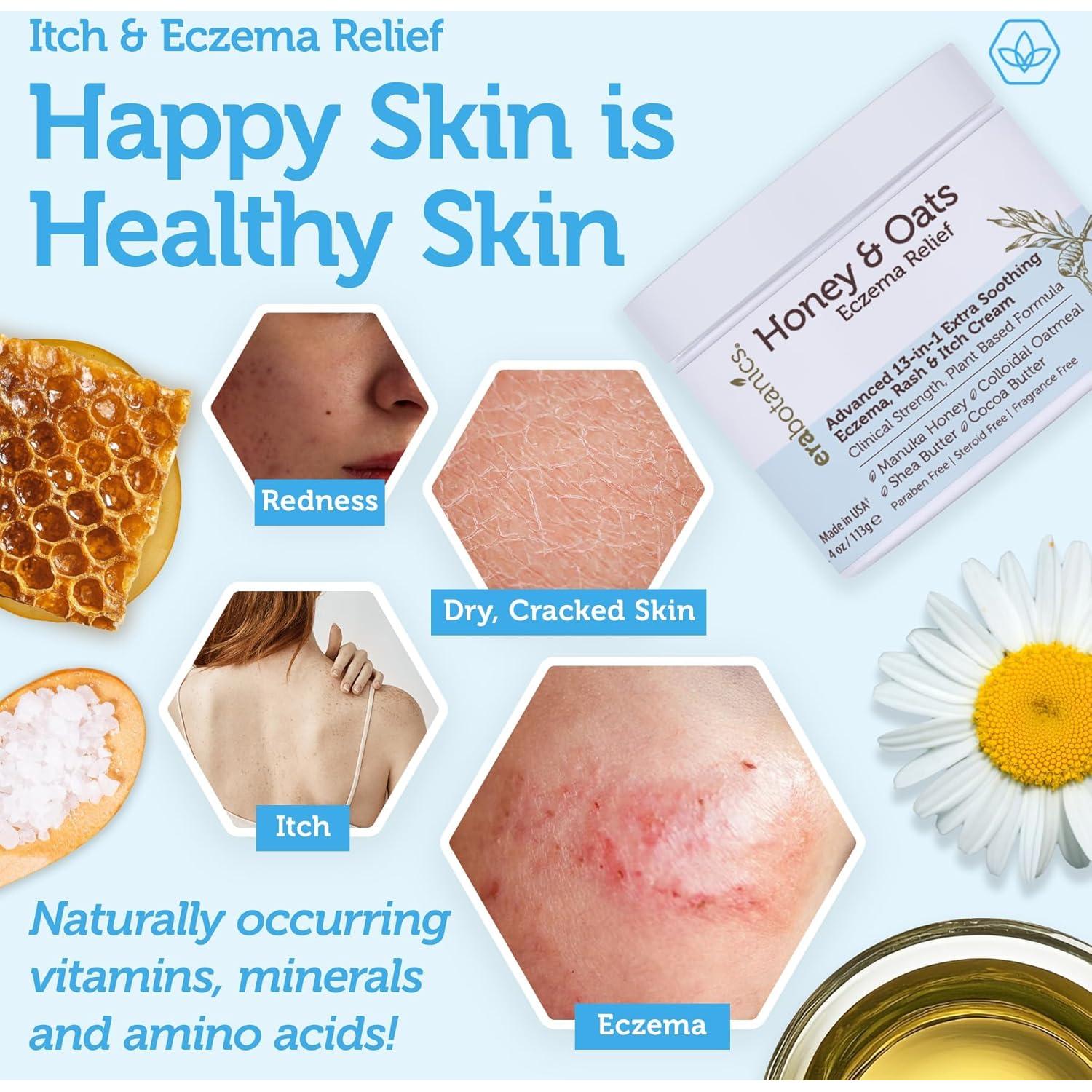 Crema para Eczema Era Organics con Miel de Manuka 113g