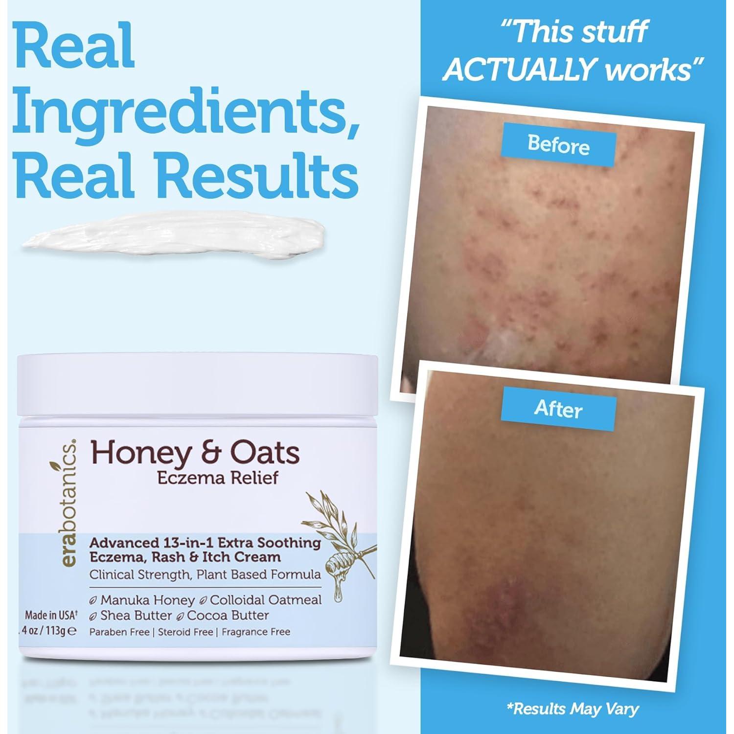 Crema para Eczema Era Organics con Miel de Manuka 113g