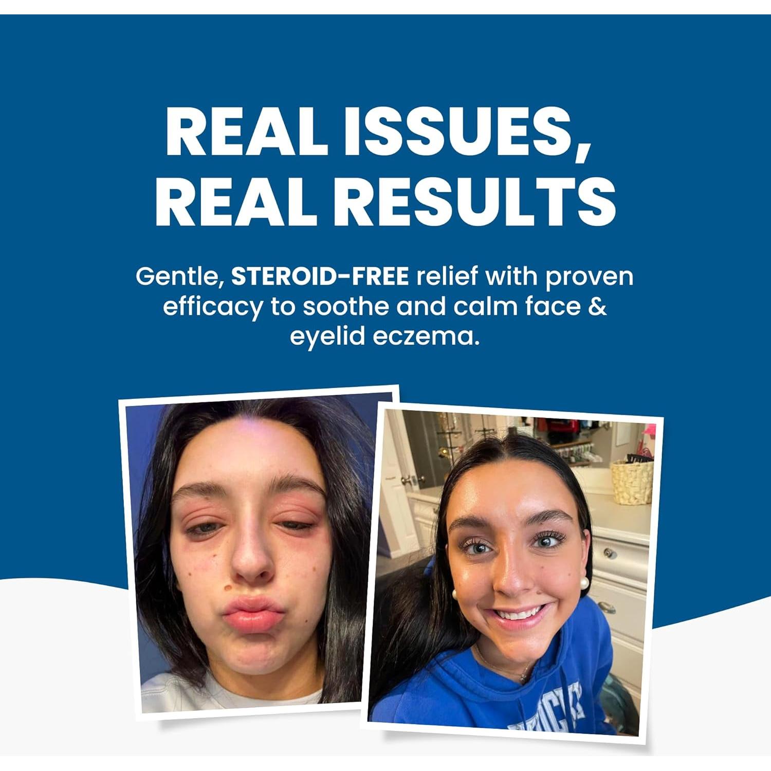 Crema Natural para la Cara y Párpados Grahams 50g - Eczema