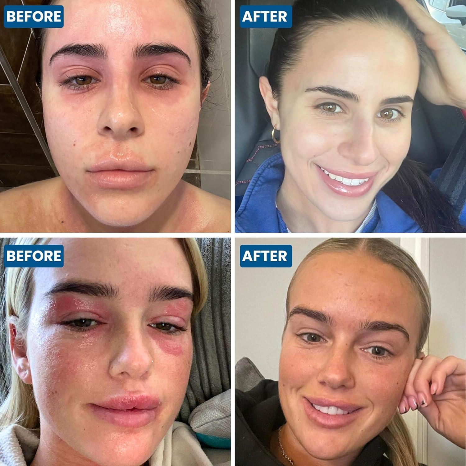 Crema Natural para la Cara y Párpados Grahams 50g - Eczema