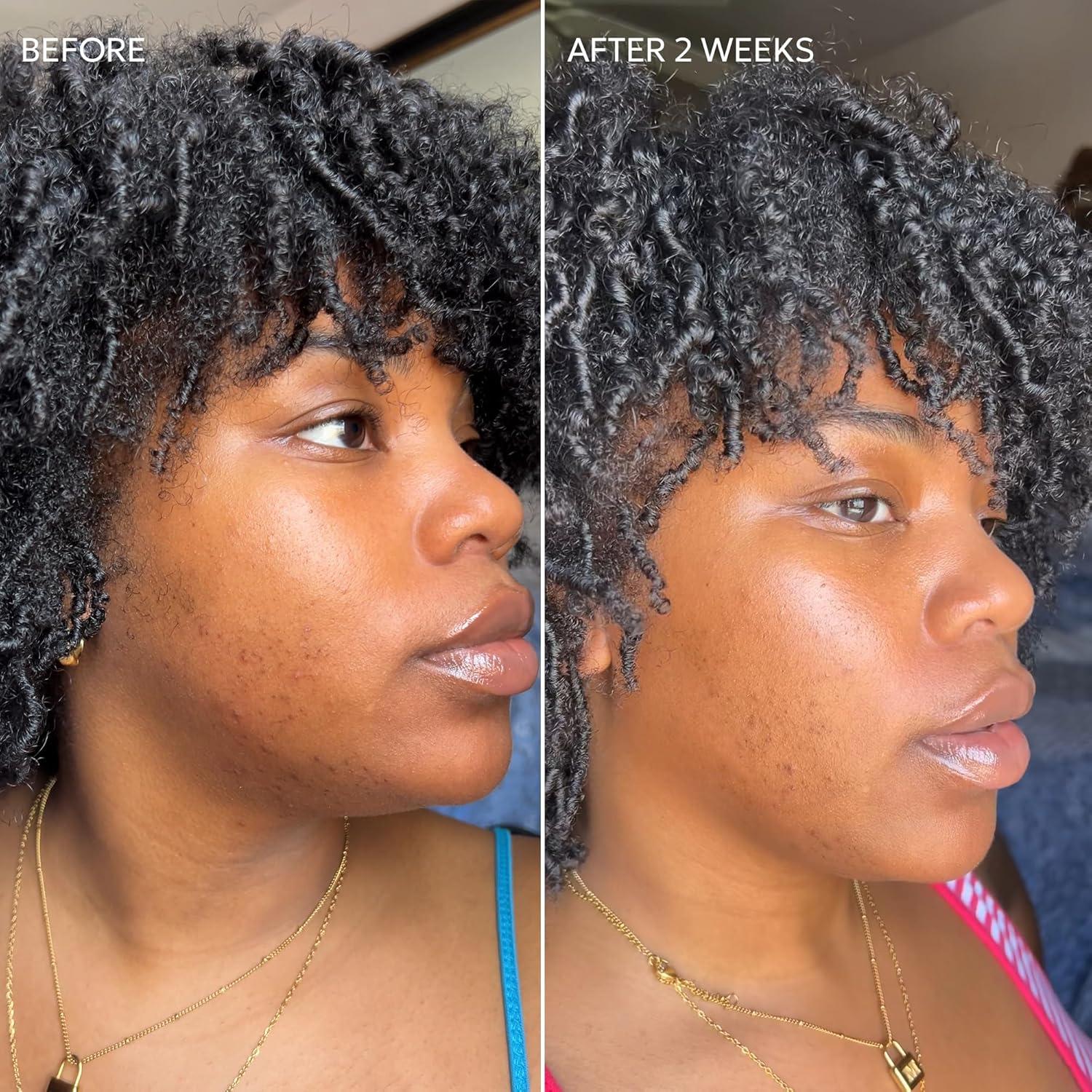 Crema Dermisa con Vitamina C 50.4 g - Aclara Manchas Oscuras