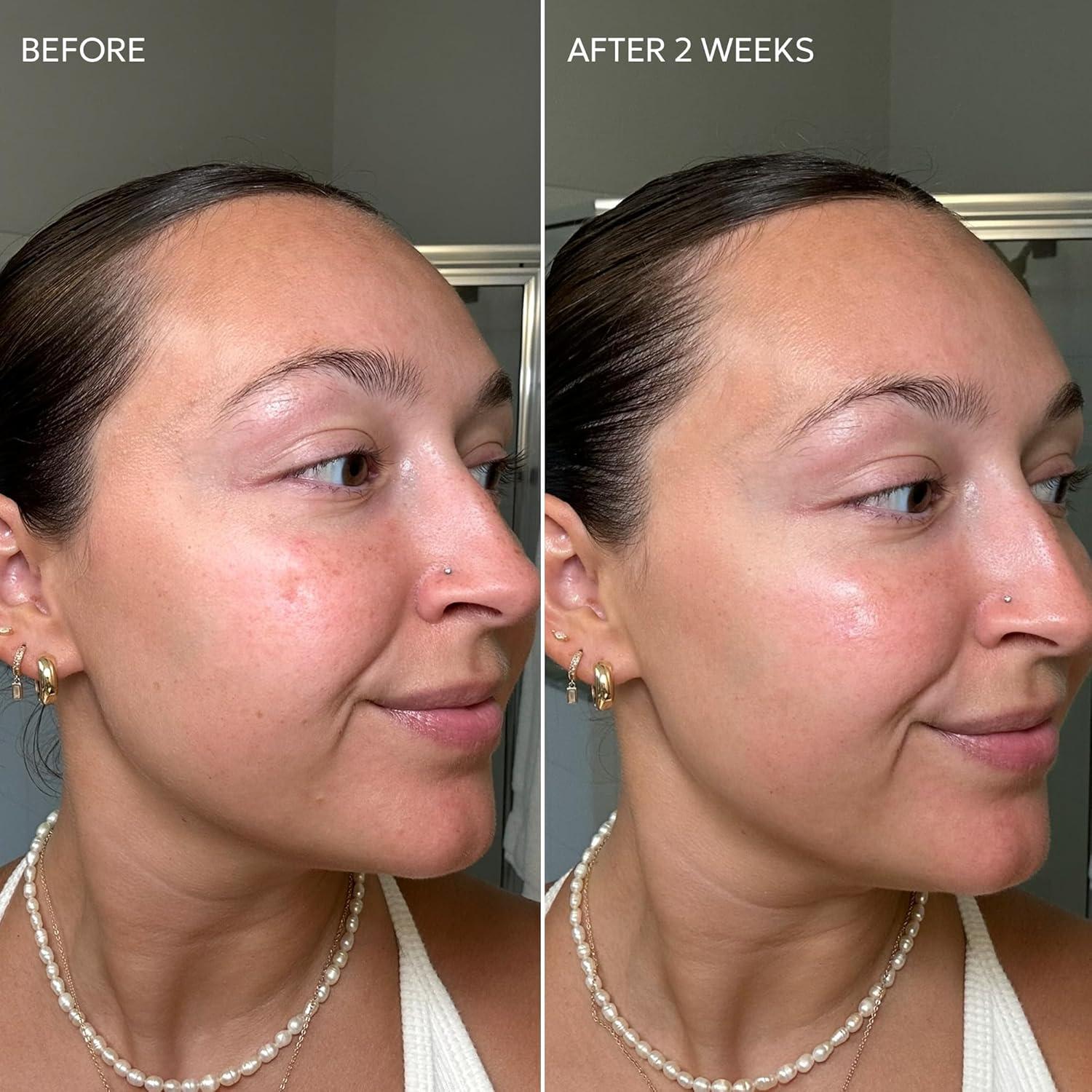 Crema Dermisa con Vitamina C 50.4 g - Aclara Manchas Oscuras