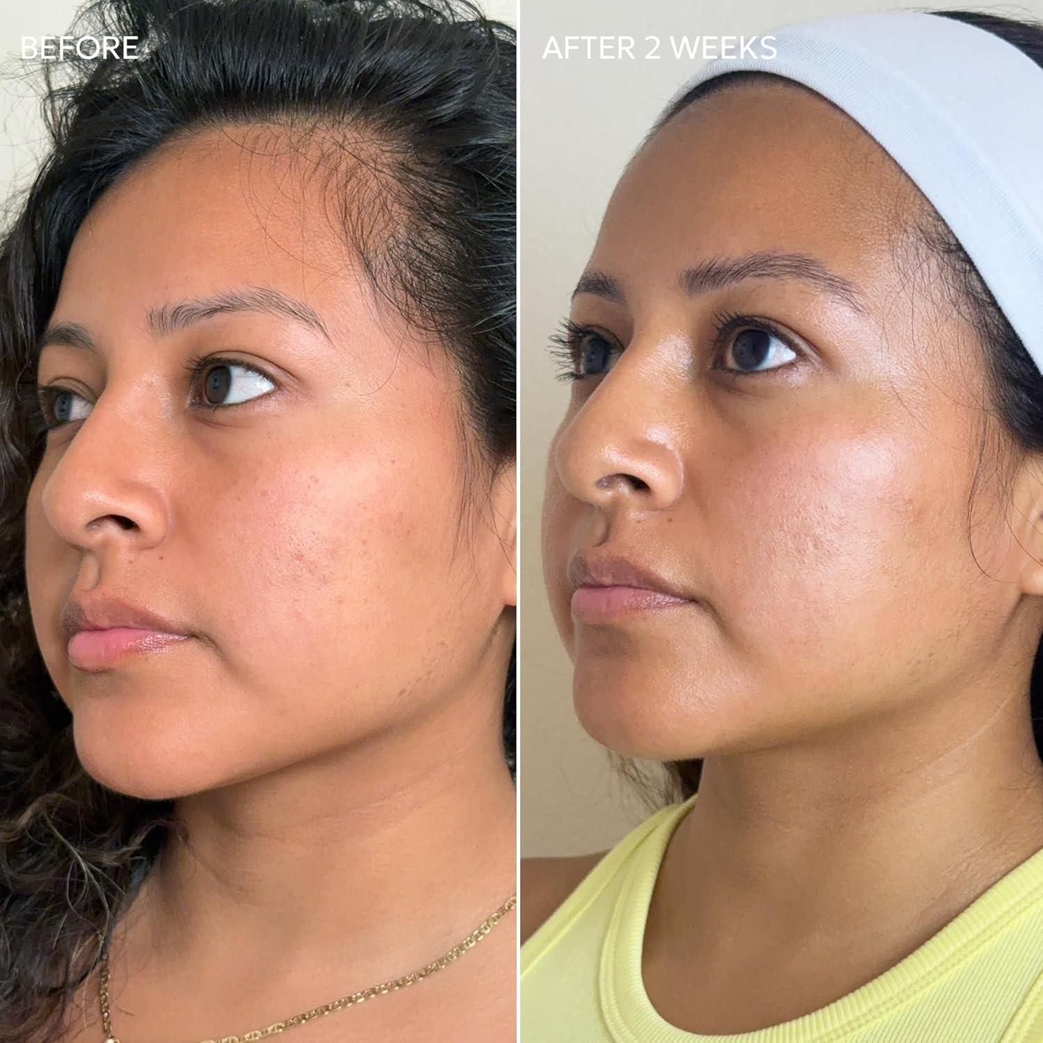 Crema Dermisa con Vitamina C 50.4 g - Aclara Manchas Oscuras