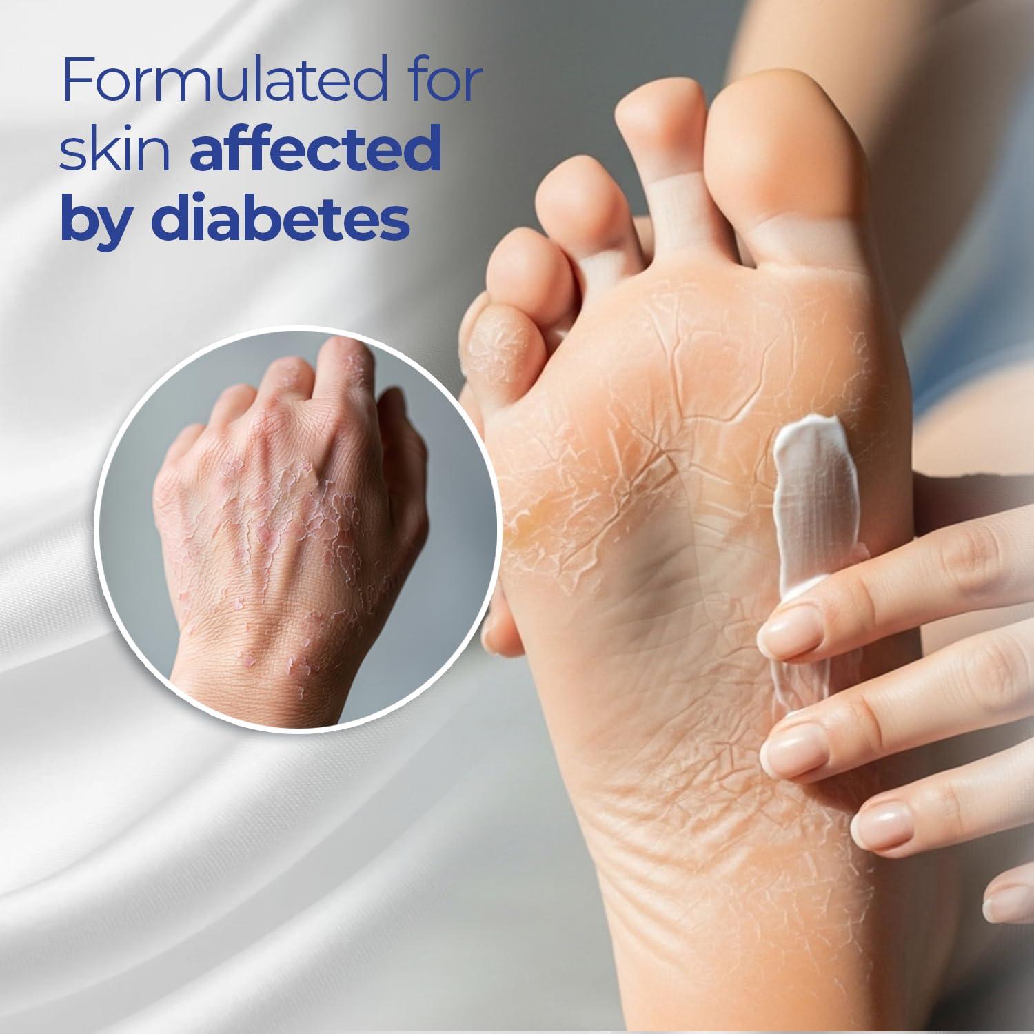 Loción Diabética Goicoechea Diabet TX 382.7 g Hidratante