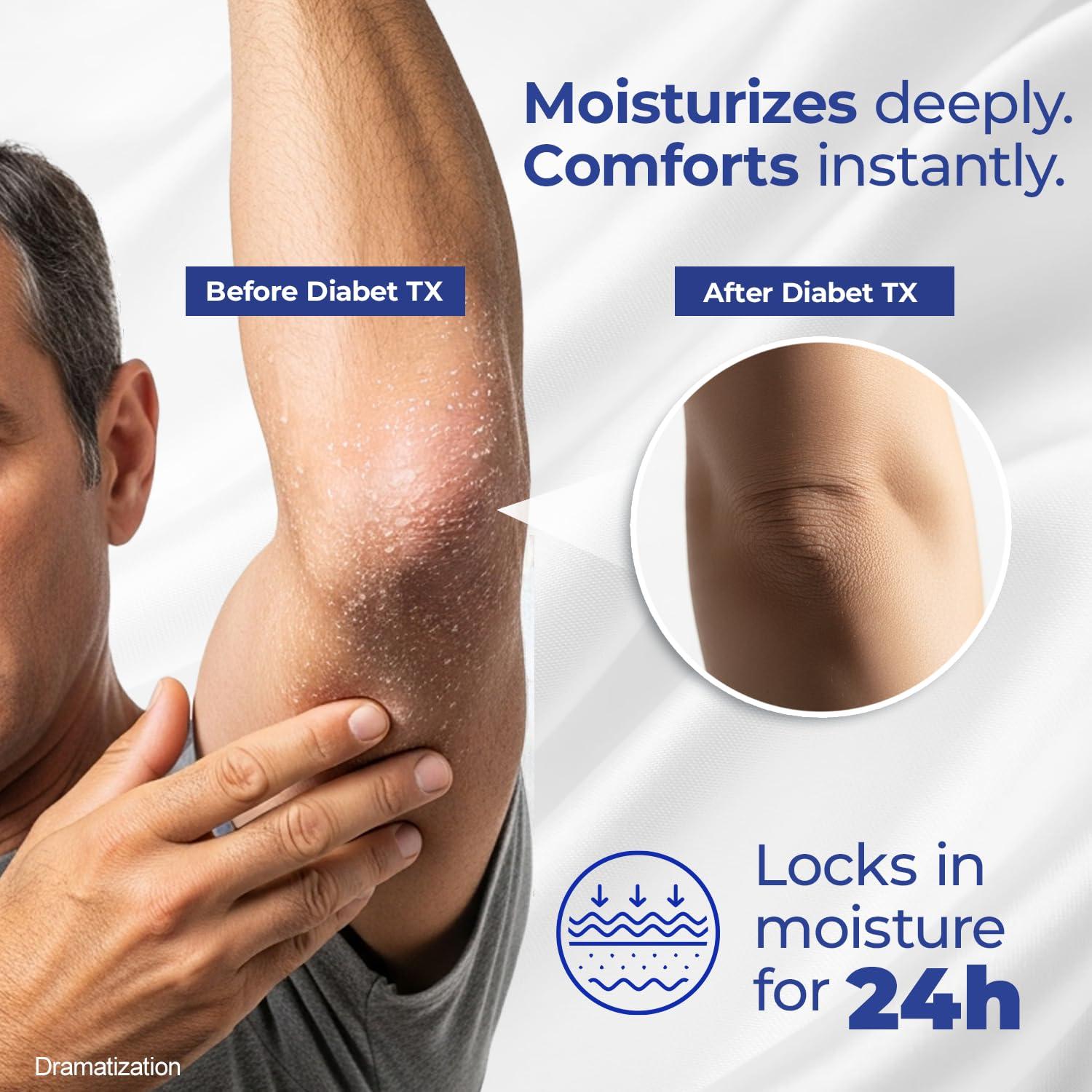 Loción Diabética Goicoechea Diabet TX 382.7 g Hidratante